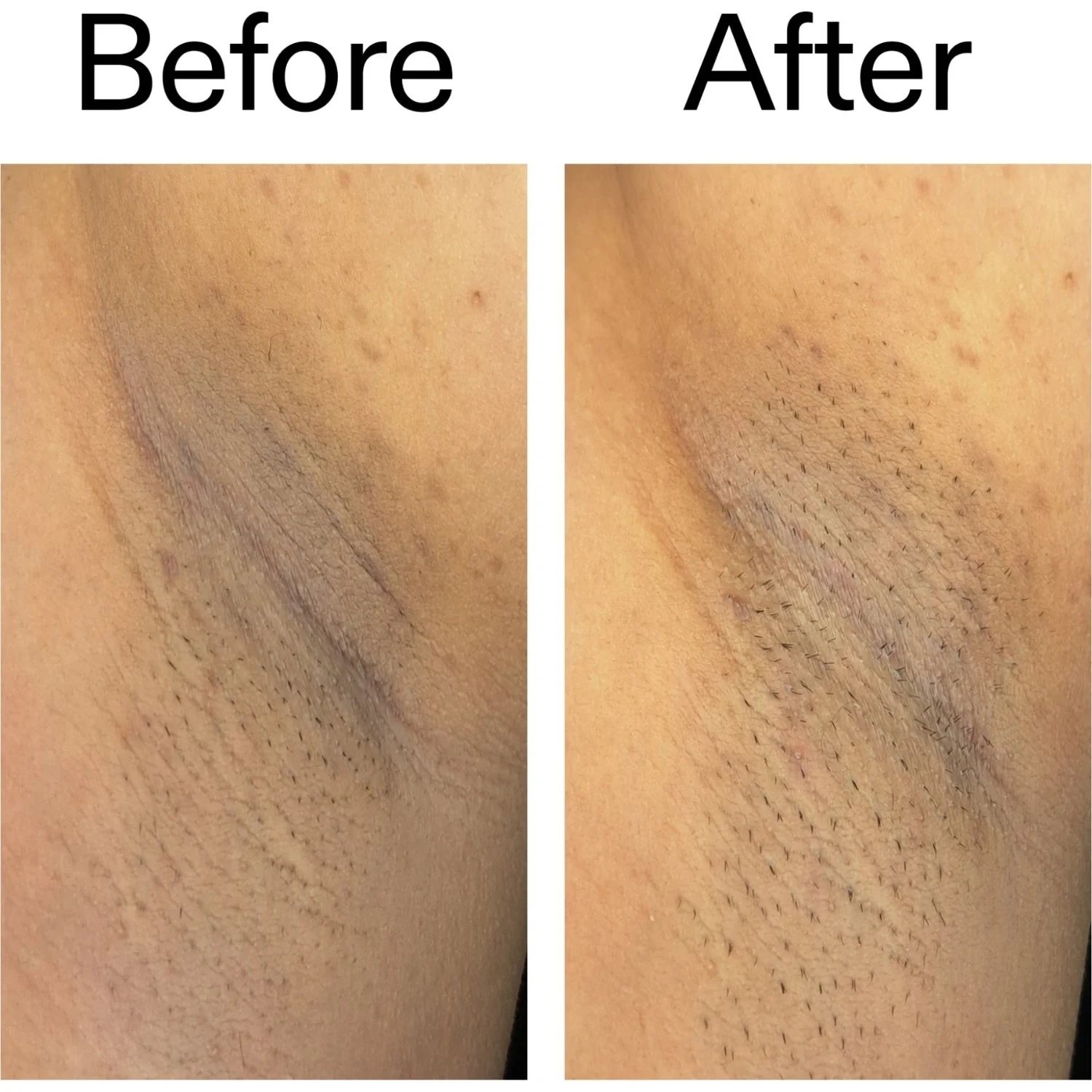 The Inkey List Glycolic Body Stick 45 g