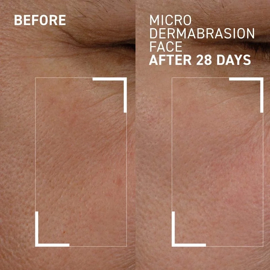Dr Brandt Microdermabrasion Face Exfoliator