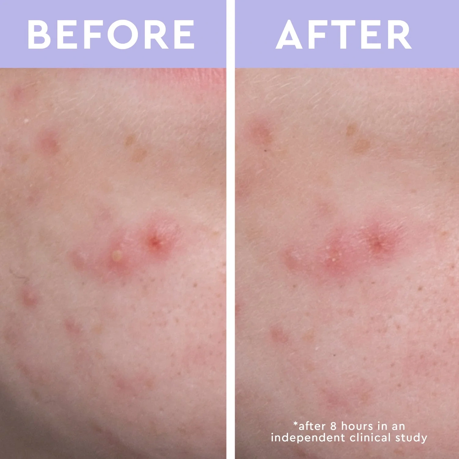 Florence by Mills Spot A Spot Blemish Patches 36p