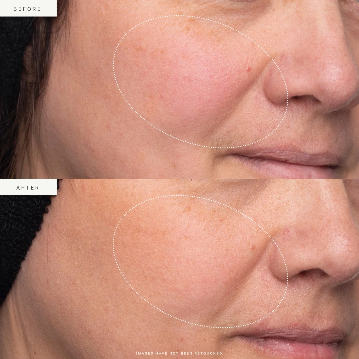 KORA Organics Turmeric Glow Moisturizer