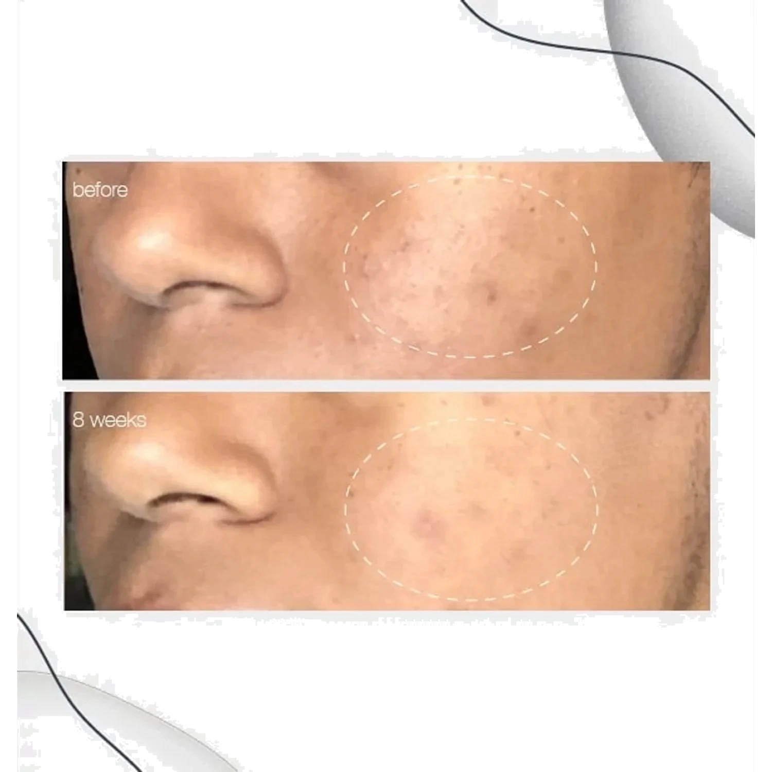 Dermalogica Powerbright Dark Spot serum