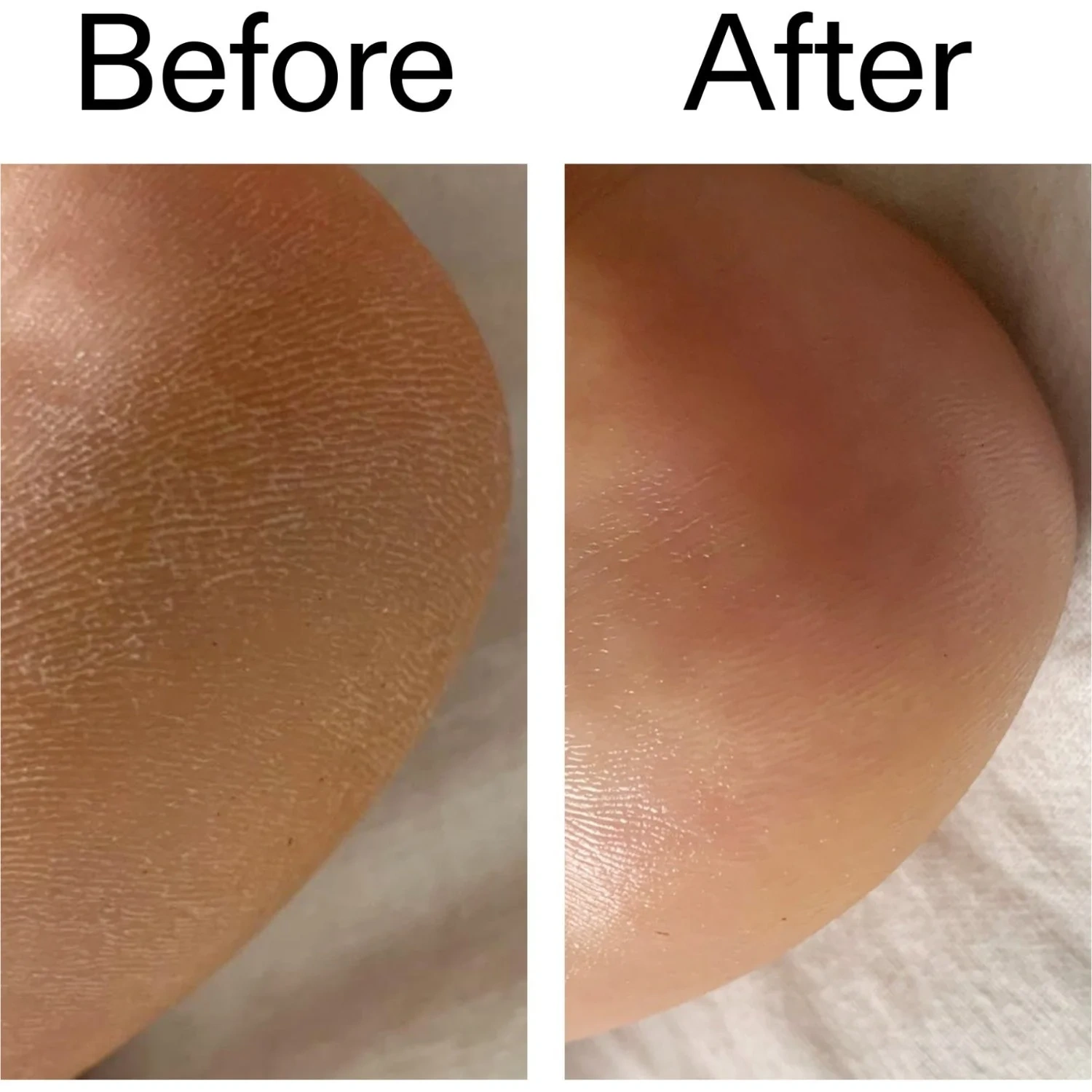 The Inkey List Glycolic Body Stick 45 g