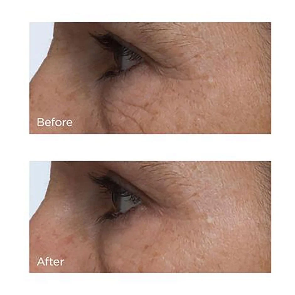 Perricone MD Cold Plasma + Eye
