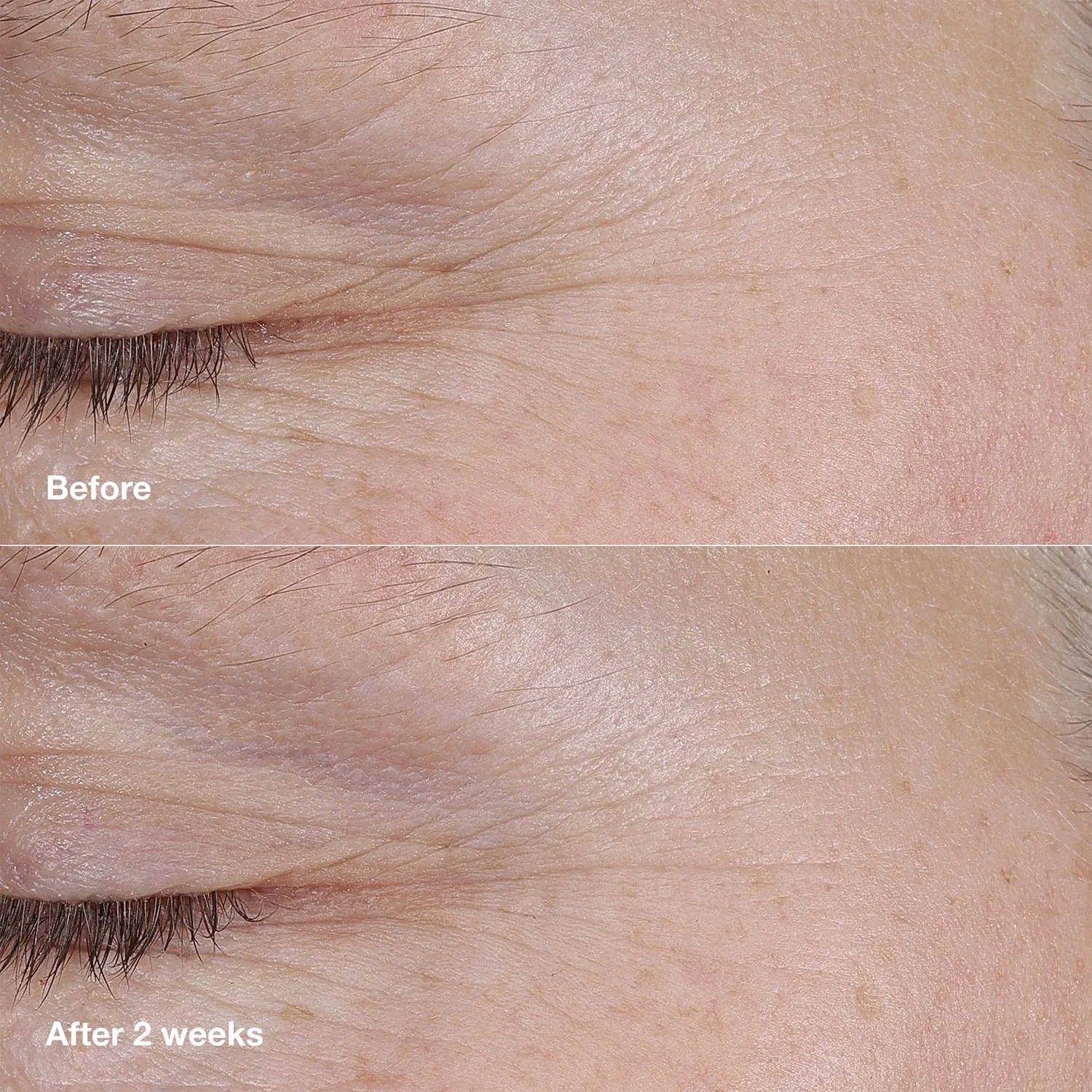 Clinique Smart Clinical Repair AM/PM Retinoid Balm 3 g