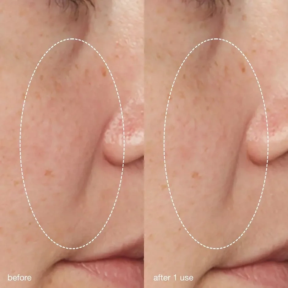 Dermalogica Daily Liquid Peelfoliant