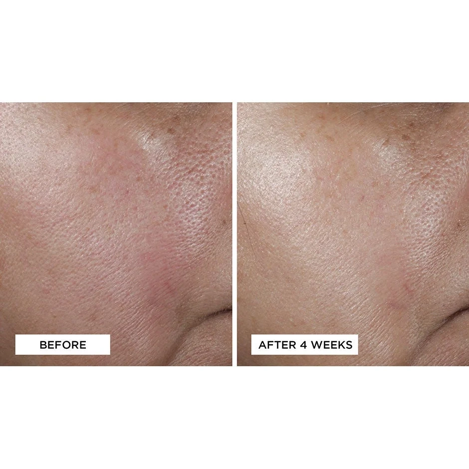 Perricone MD No:Rinse Intensive Pore Minimizing Toner