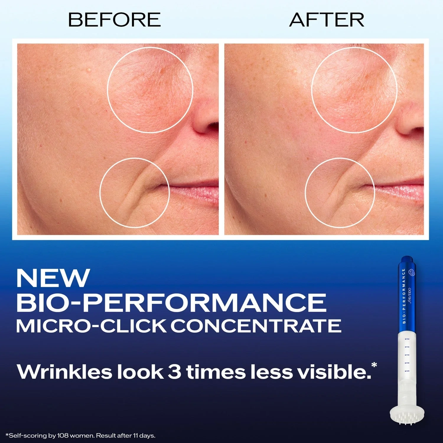 Shiseido Bio Performance 2.0 Micro Needle