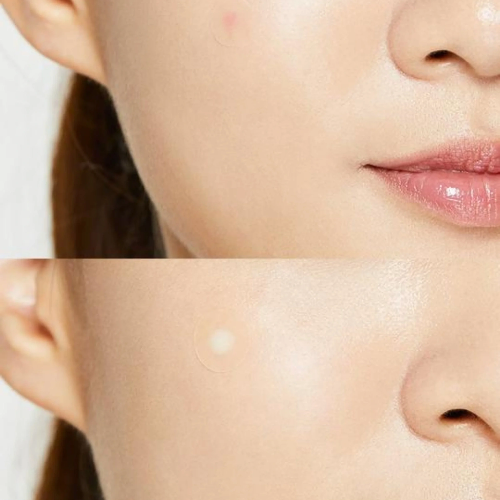 COSRX Acne Pimple Master Patch
