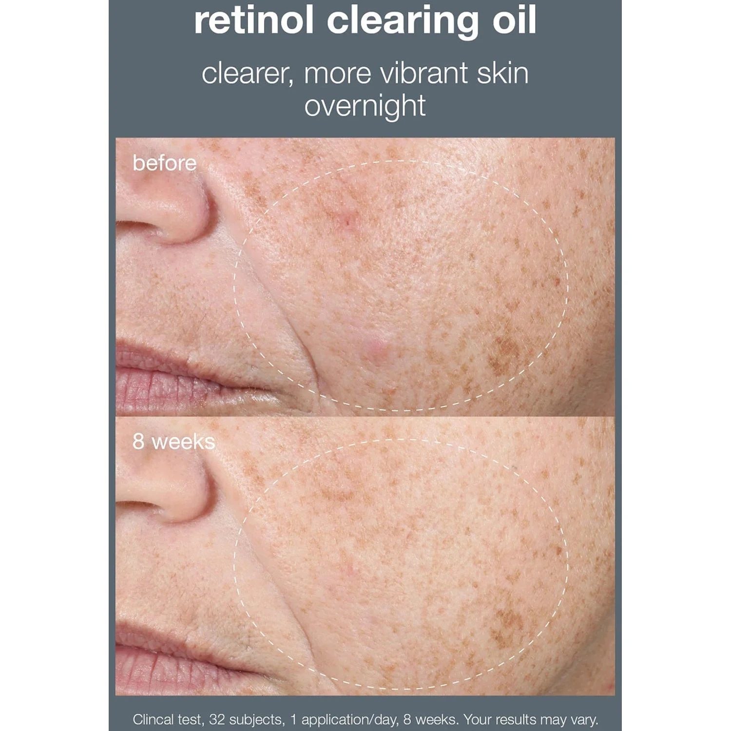 Dermalogica Retinol Clearing Oil 30 ml