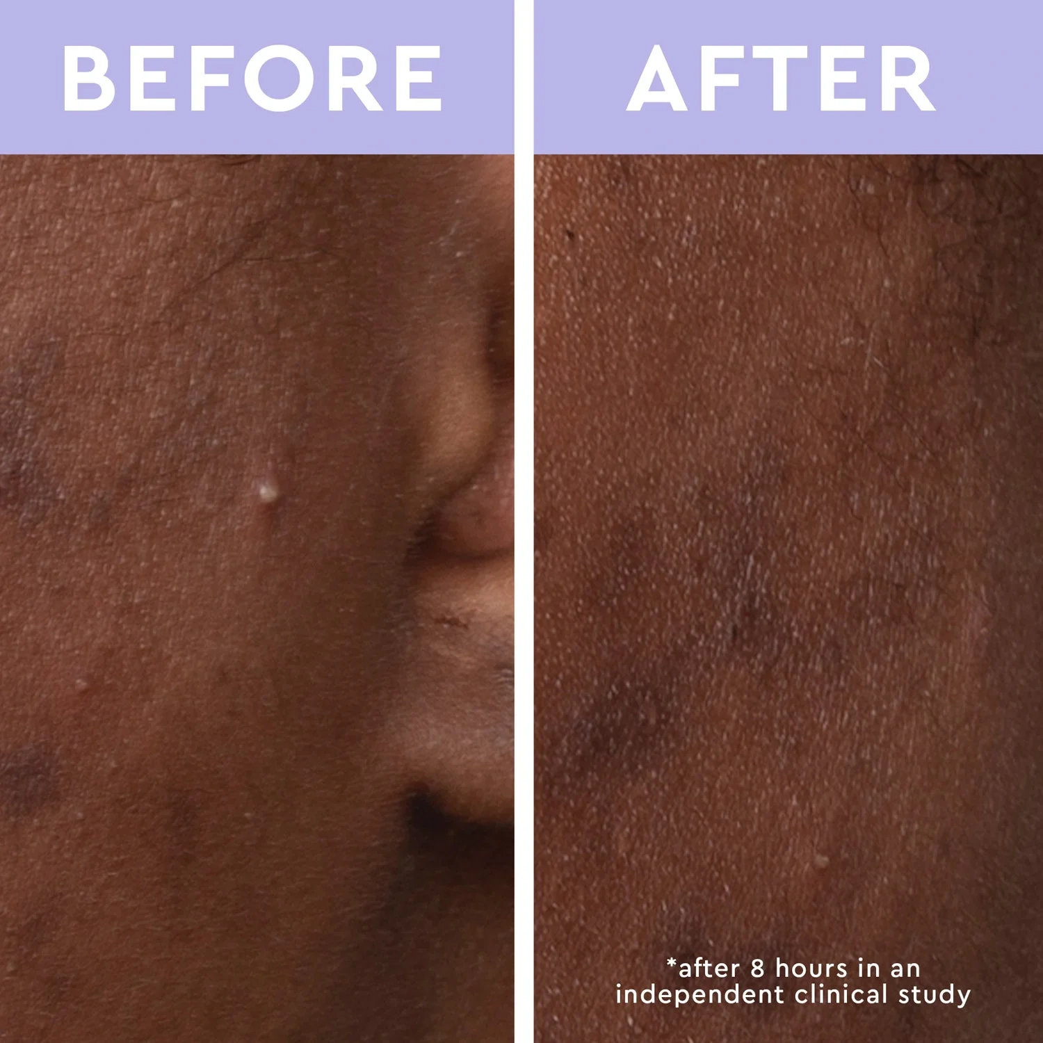 Florence by Mills Spot A Spot Blemish Patches 36p