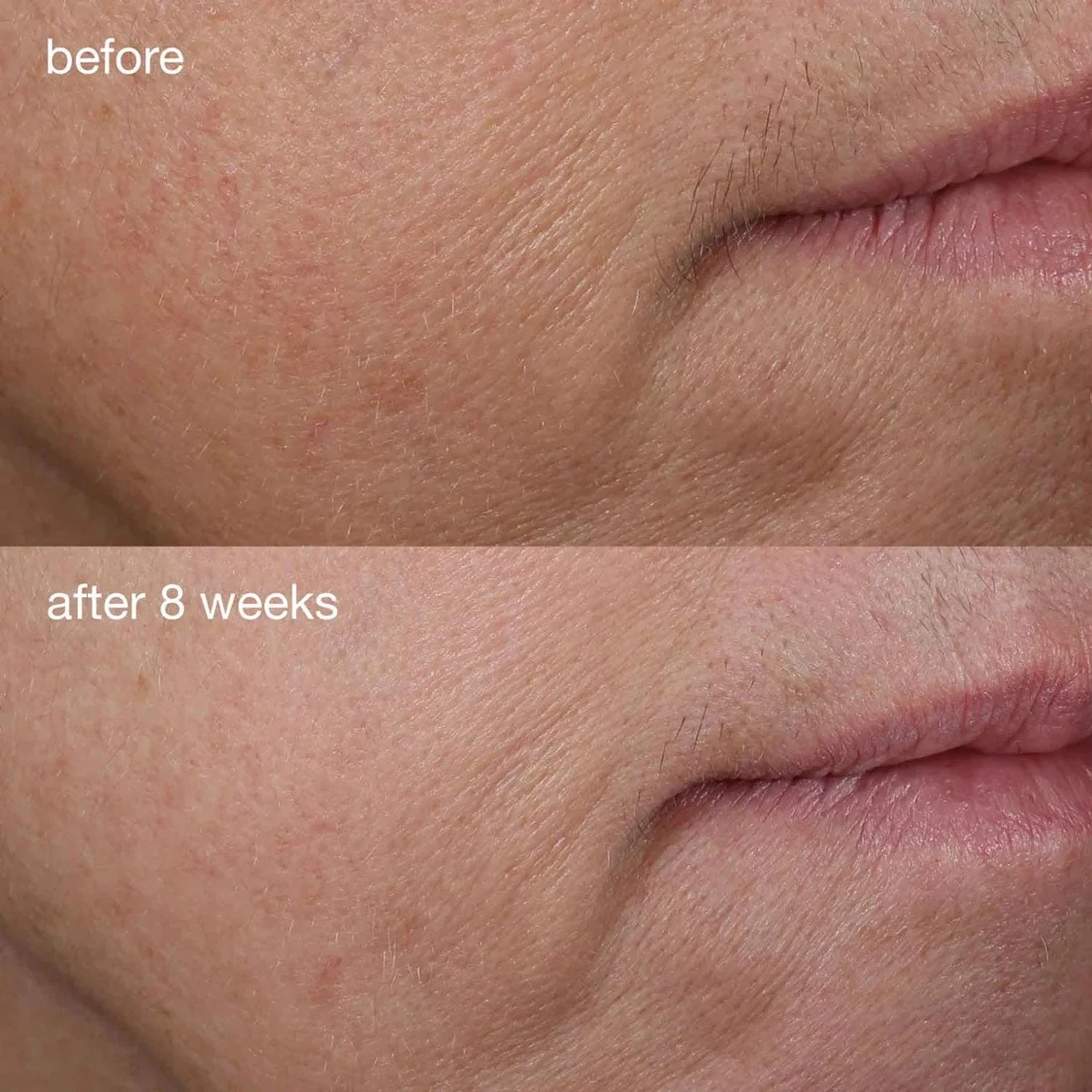 Dermalogica AGE smart