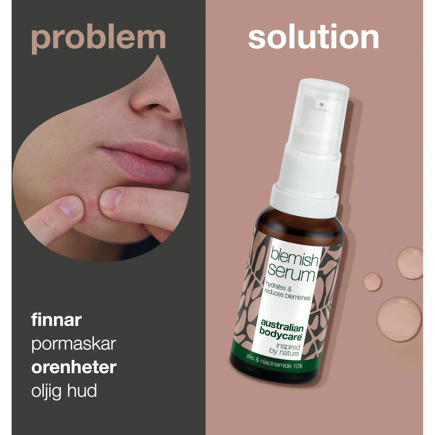 Australian Bodycare 10% Niacinamide Blemish Serum – For Pimples, Blackheads And Oily Skin 30 ml