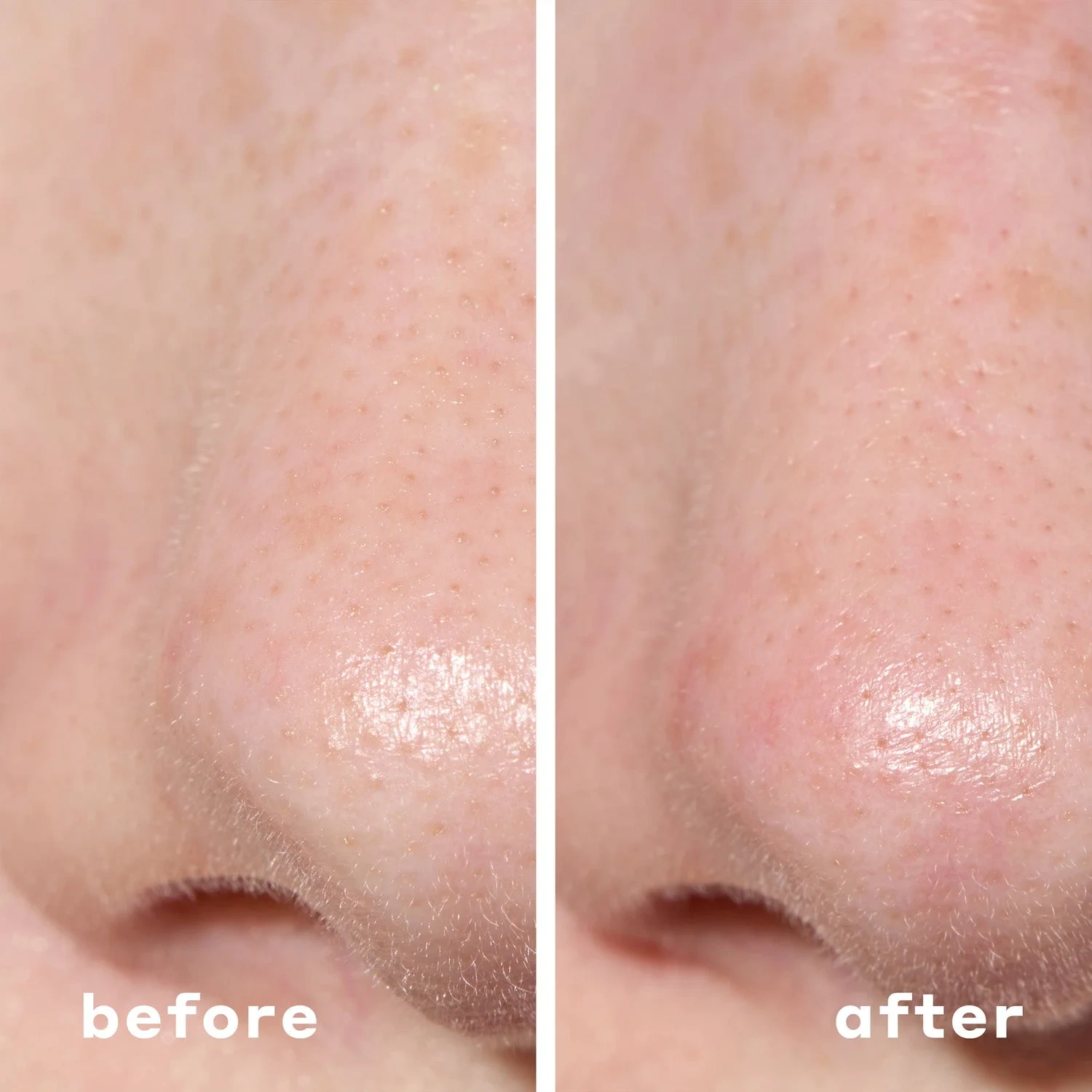 Mario Badescu 2-In-1 Deep Cleansing Pore Strip
