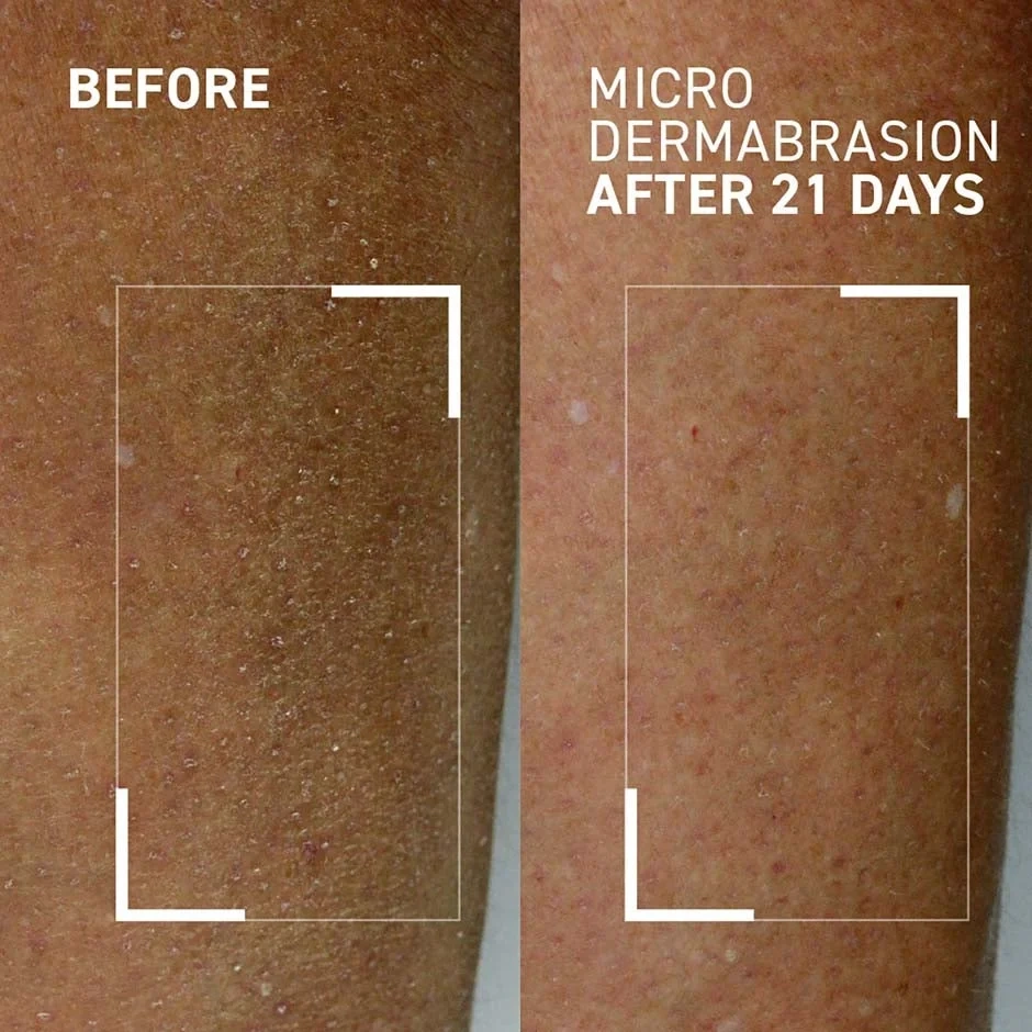 Dr Brandt Microdermabrasion Body Exfoliator