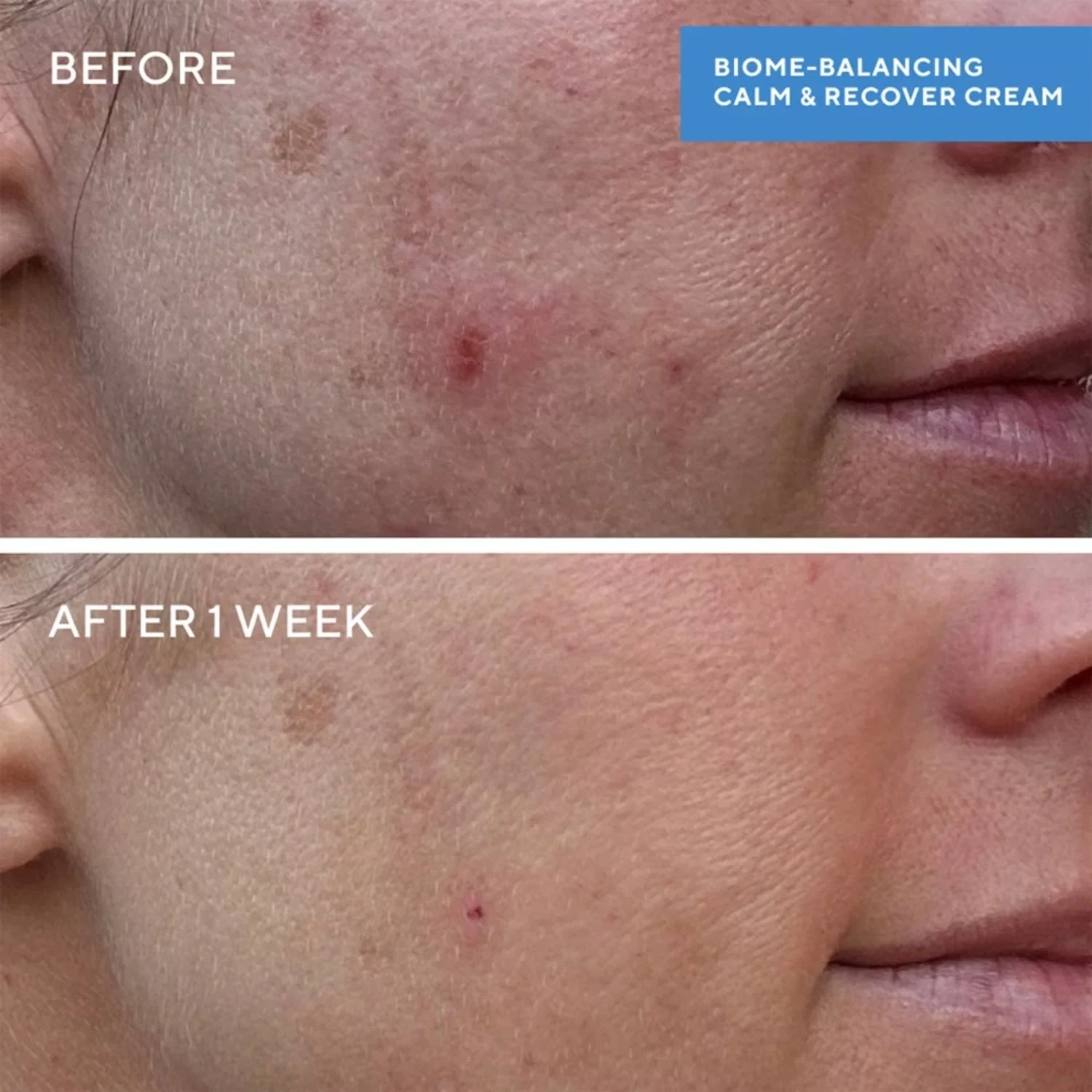 Murad Biome-Balancing Calm + Recover Cream