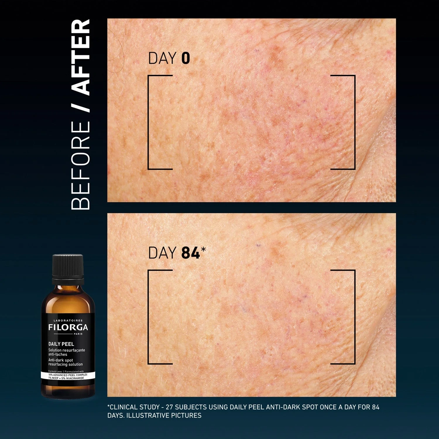 Filorga Daily Peel Anti-Dark Spot Resurfacing Solution 50 ml