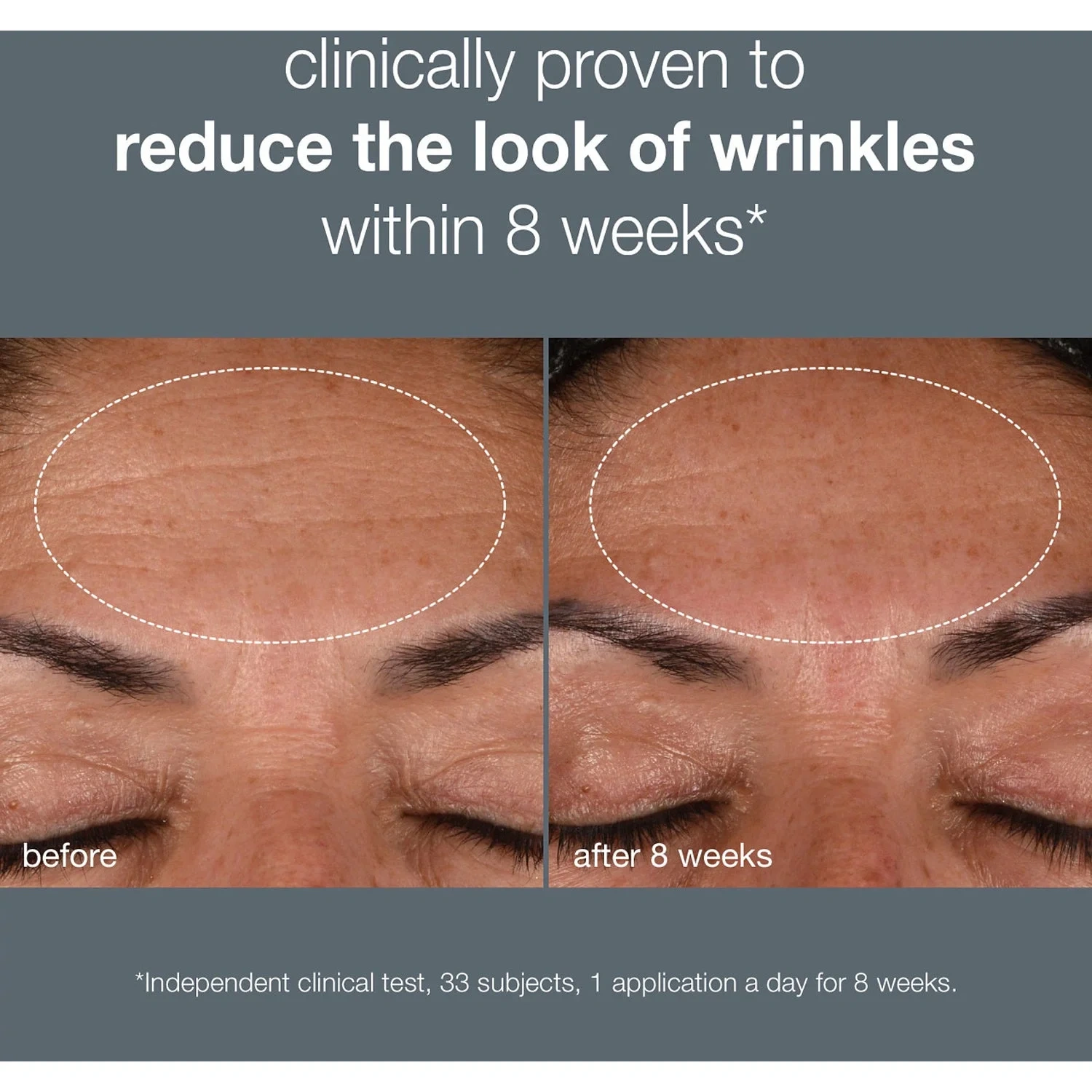 Dermalogica Dynamic Skin Recovery