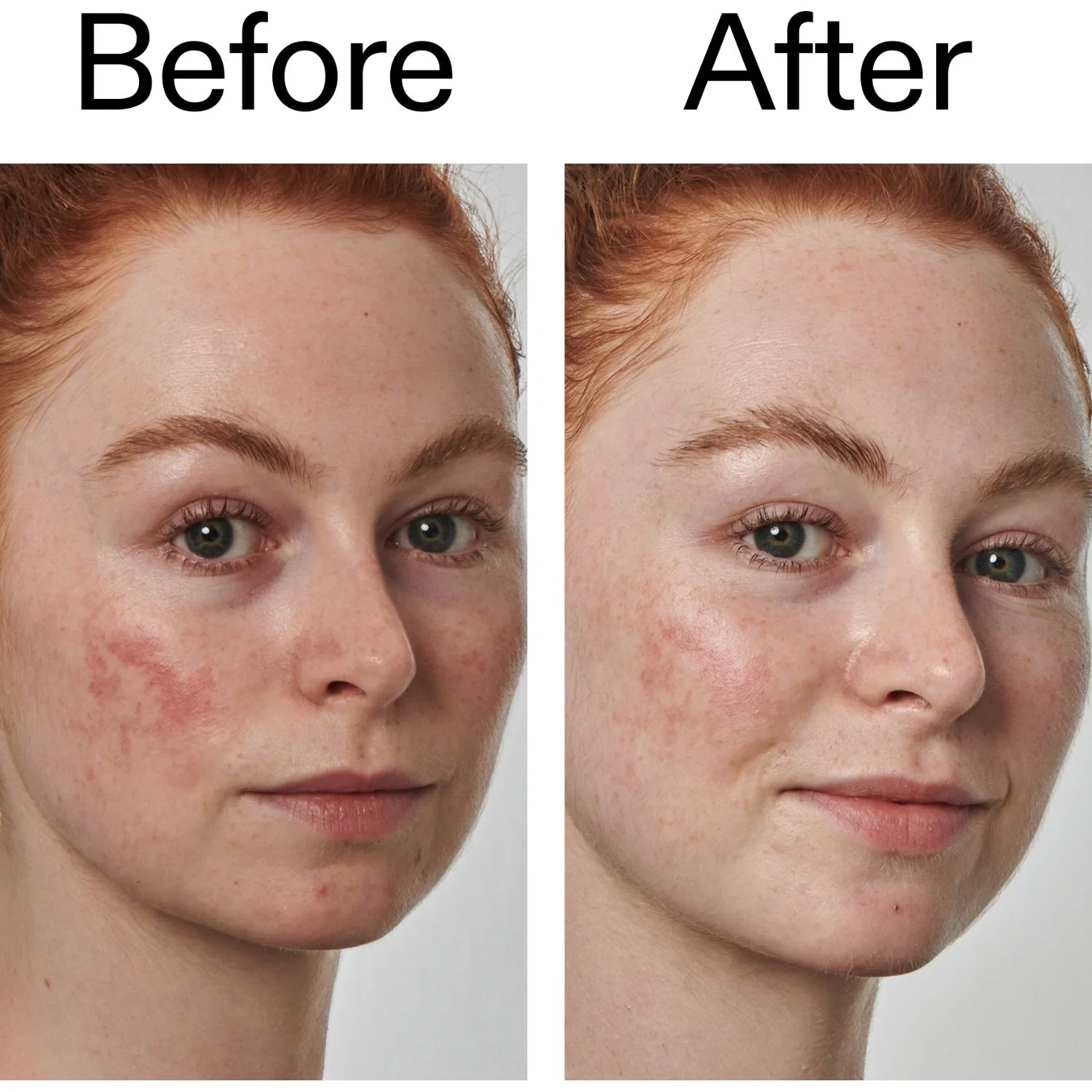 The INKEY List Azelaic Acid 10% Serum