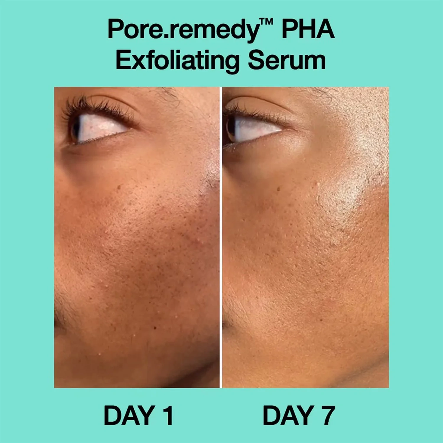 Dr.Jart+ Pore-remedy PHA Exfoliating Serum