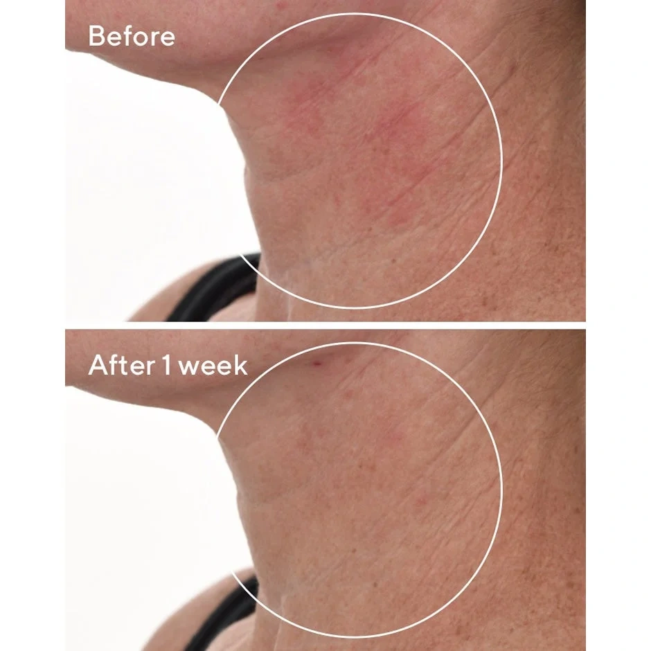 Murad Cellular Hydration Repair Serum