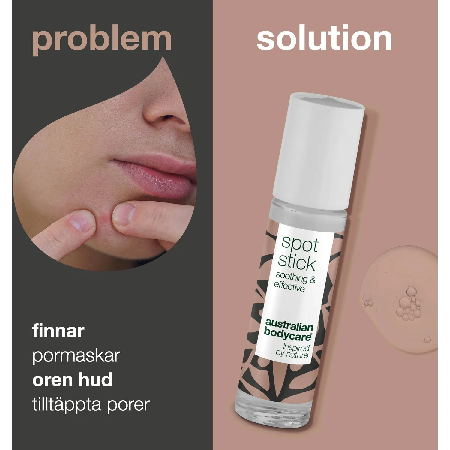 Australian Bodycare Spot Stick