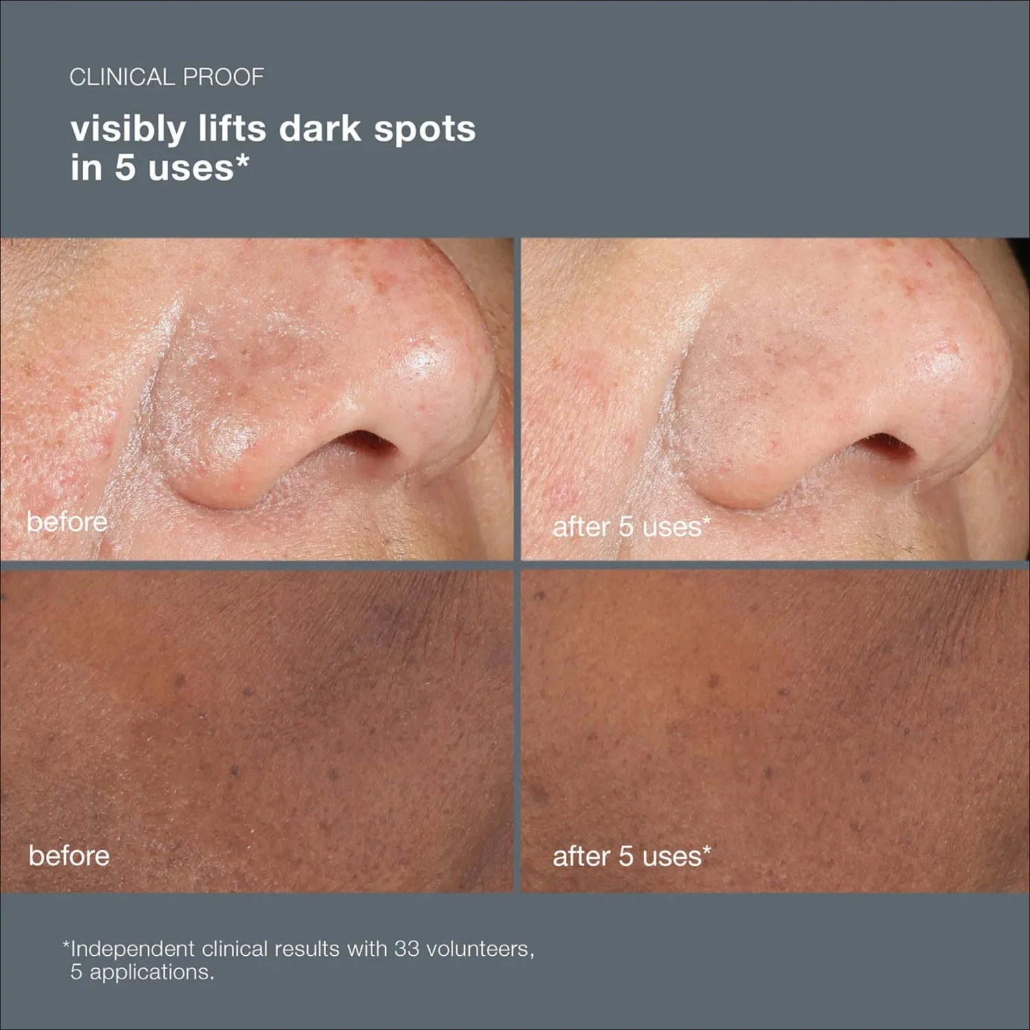 Dermalogica PowerBright Dark Spot Peel