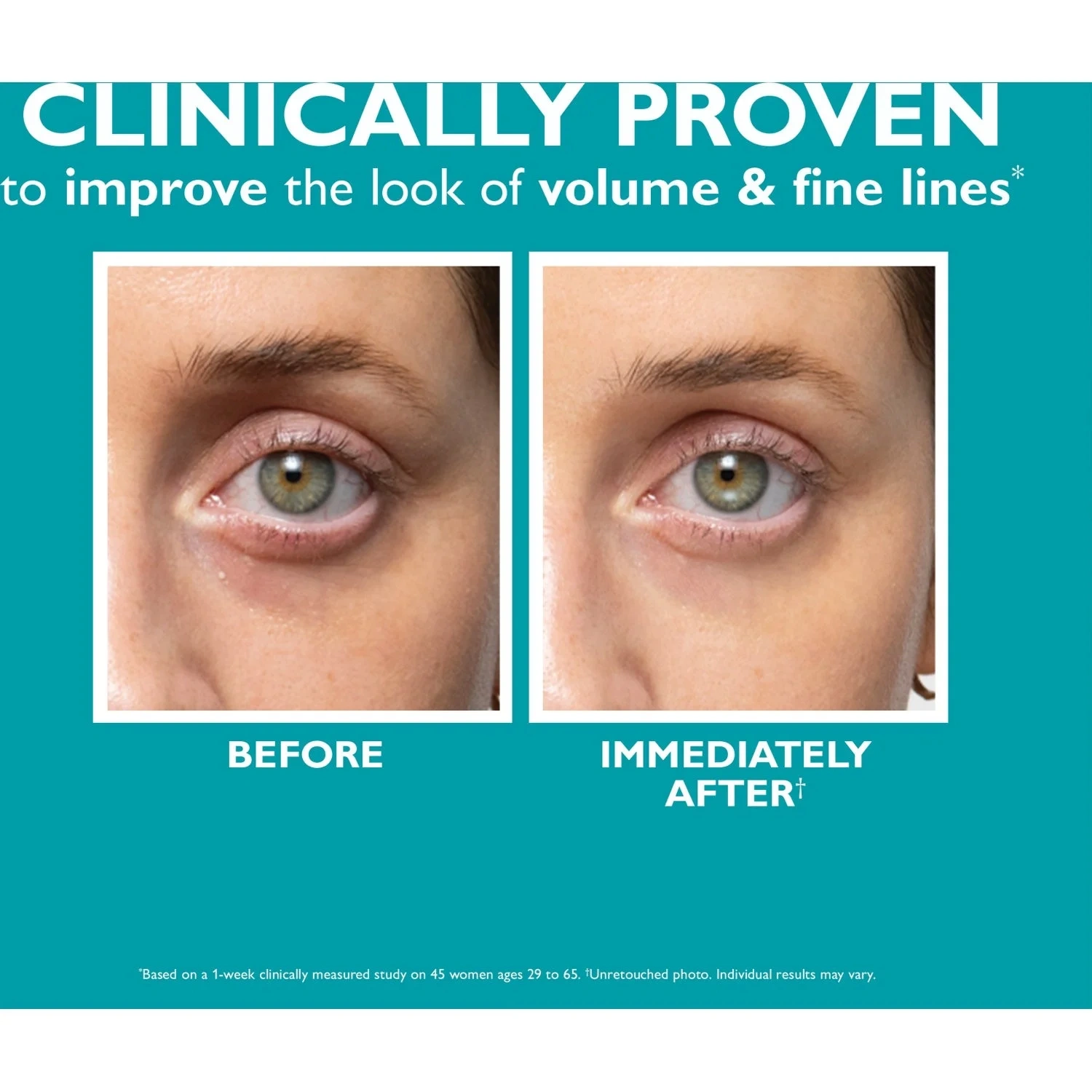Peter Thomas Roth Peptide Skinjection™ Fill + Fix Under-Eye Cream