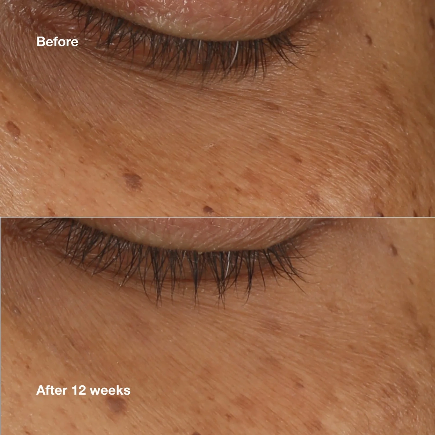 Clinique All About Eyes Brightening Serum Concentrate
