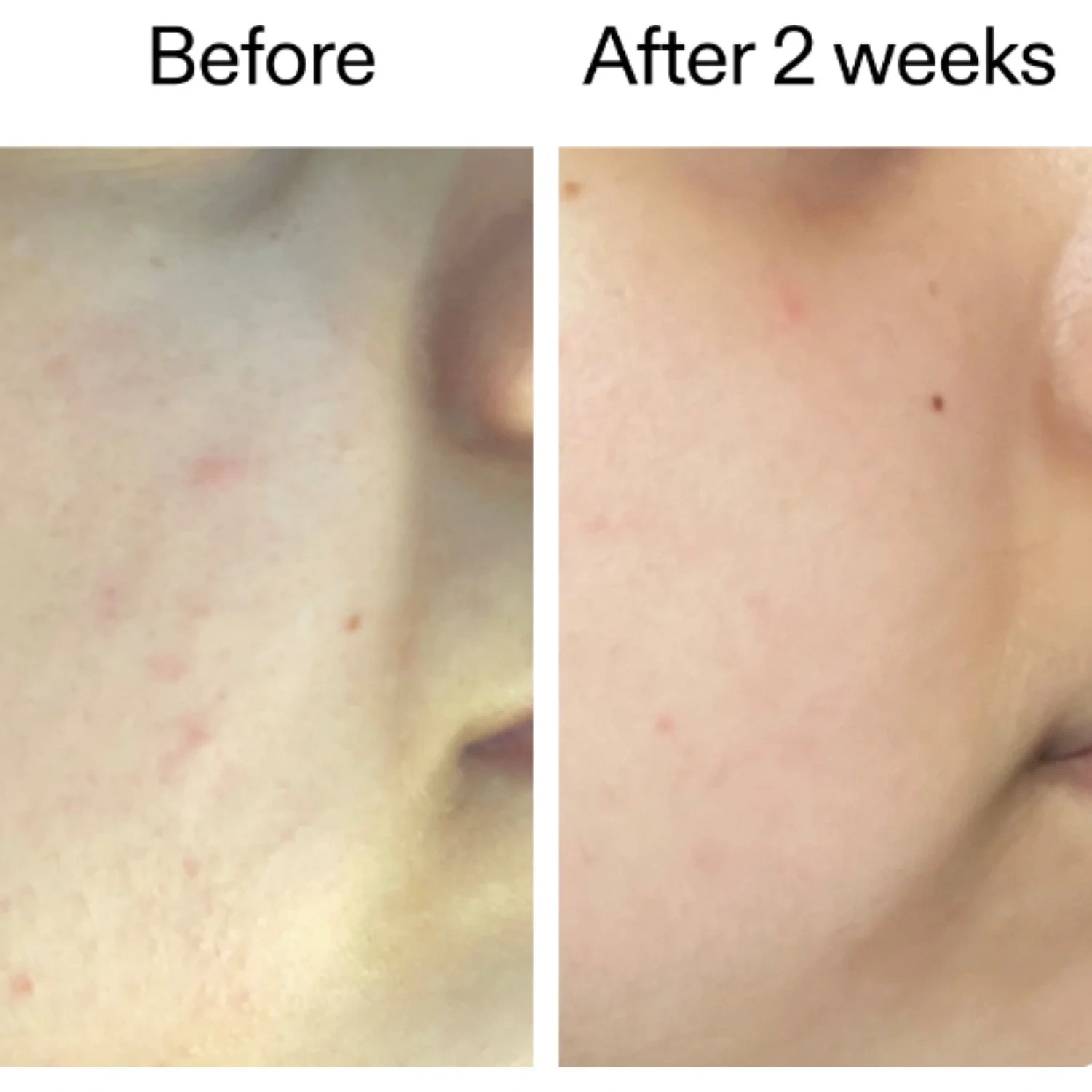 The INKEY List 360° Skin Clearing Serum 30 ml