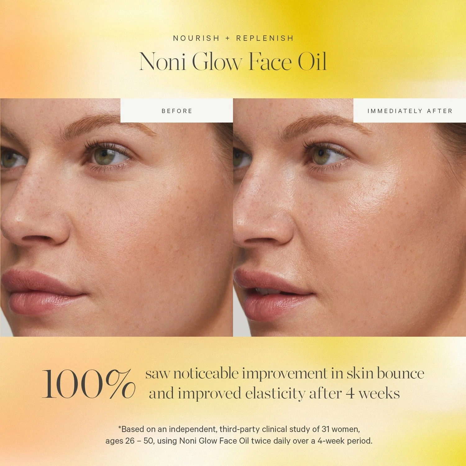 KORA Organics Noni Glow Face Oil