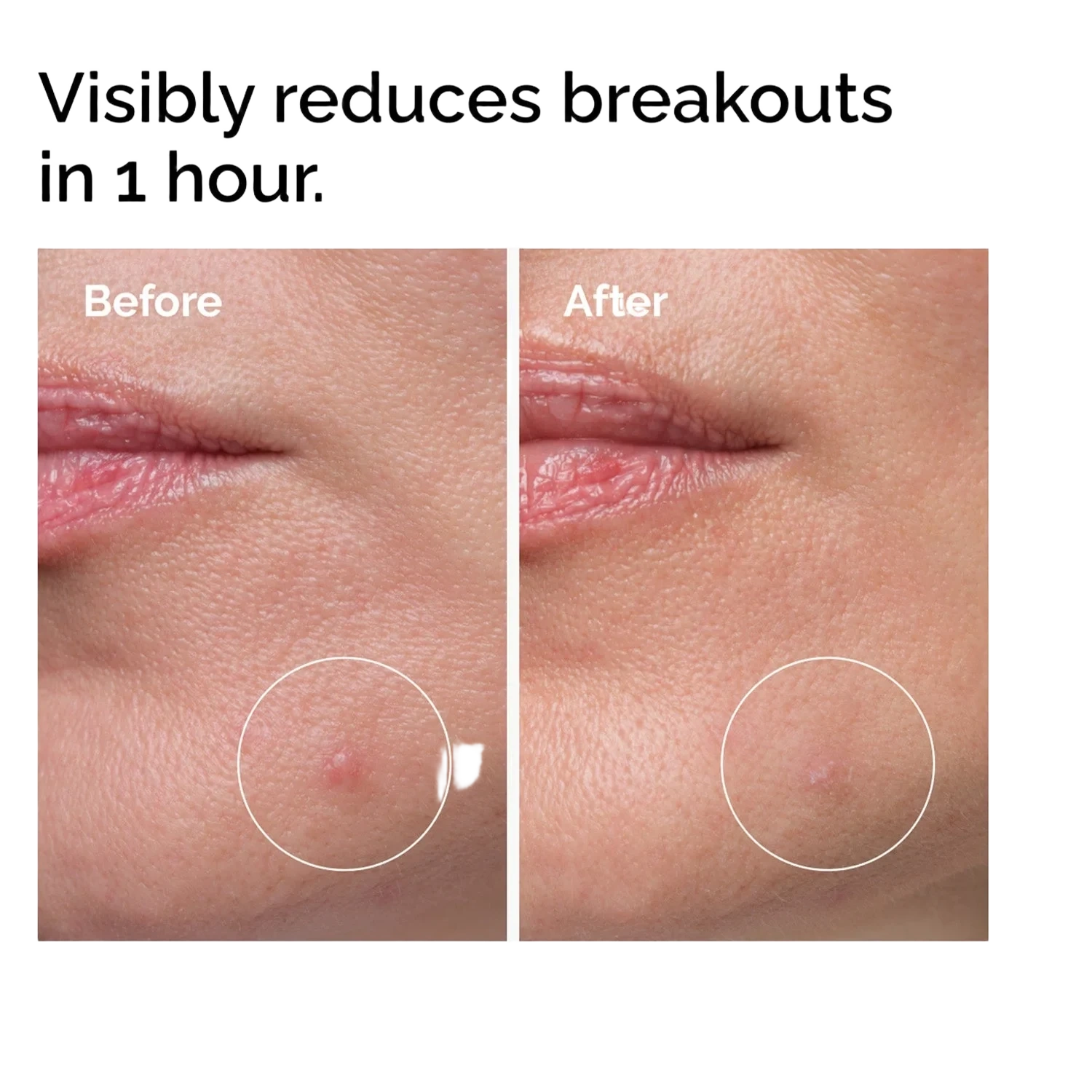 The Ordinary Sulfur 10% Powder-To-Cream Concentrate