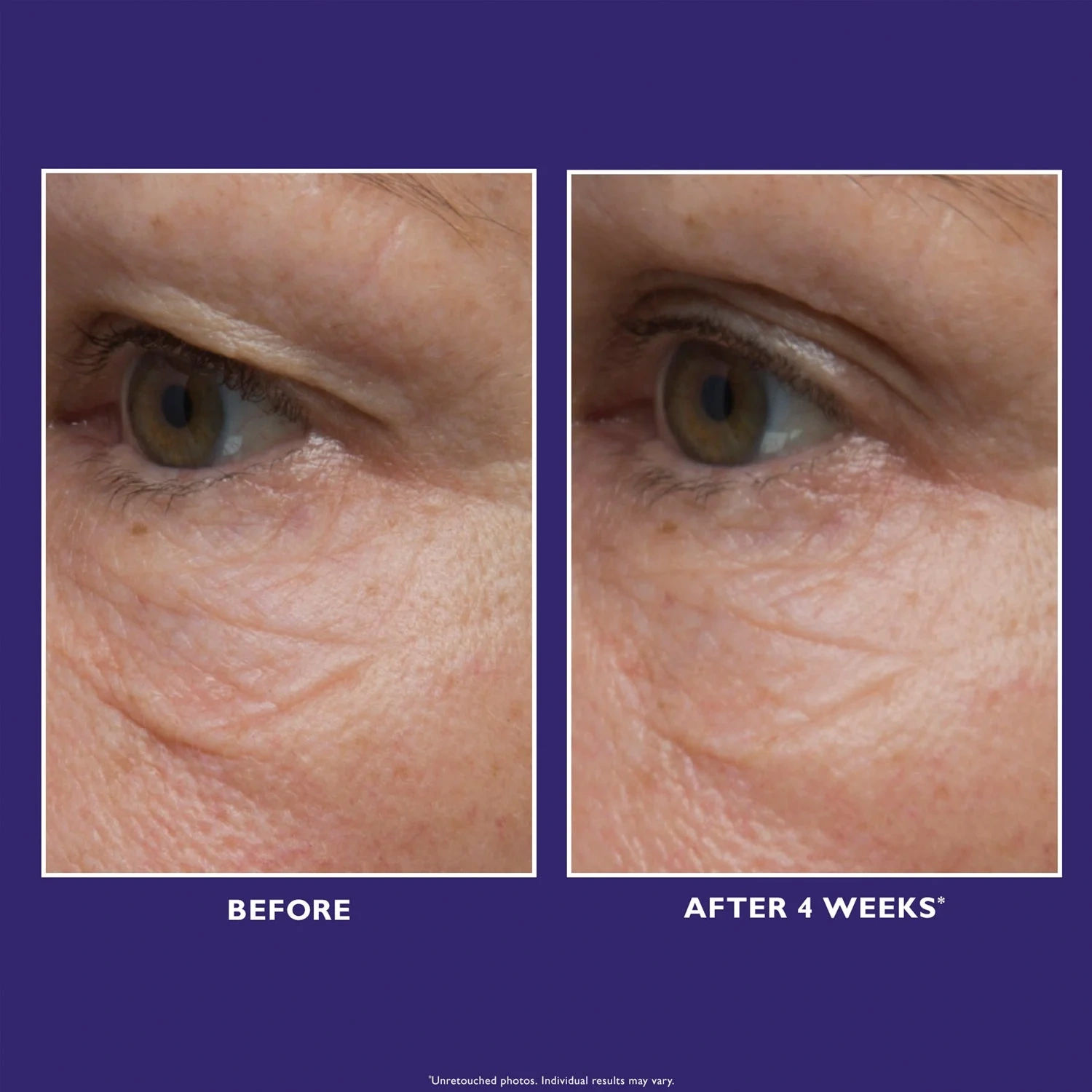 Peter Thomas Roth Ultimate Solution 5™ Eye Cream