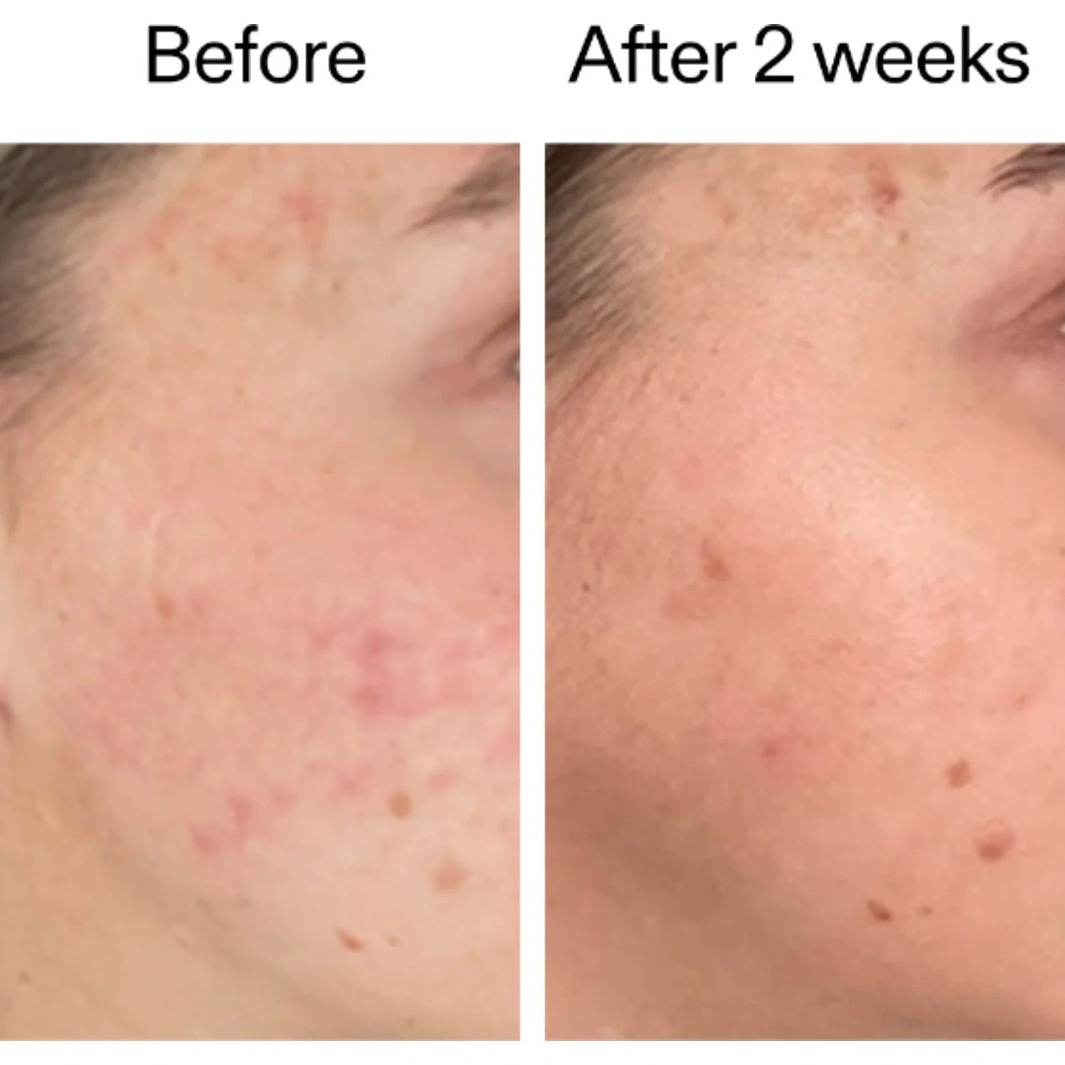 The INKEY List 360° Skin Clearing Serum 30 ml