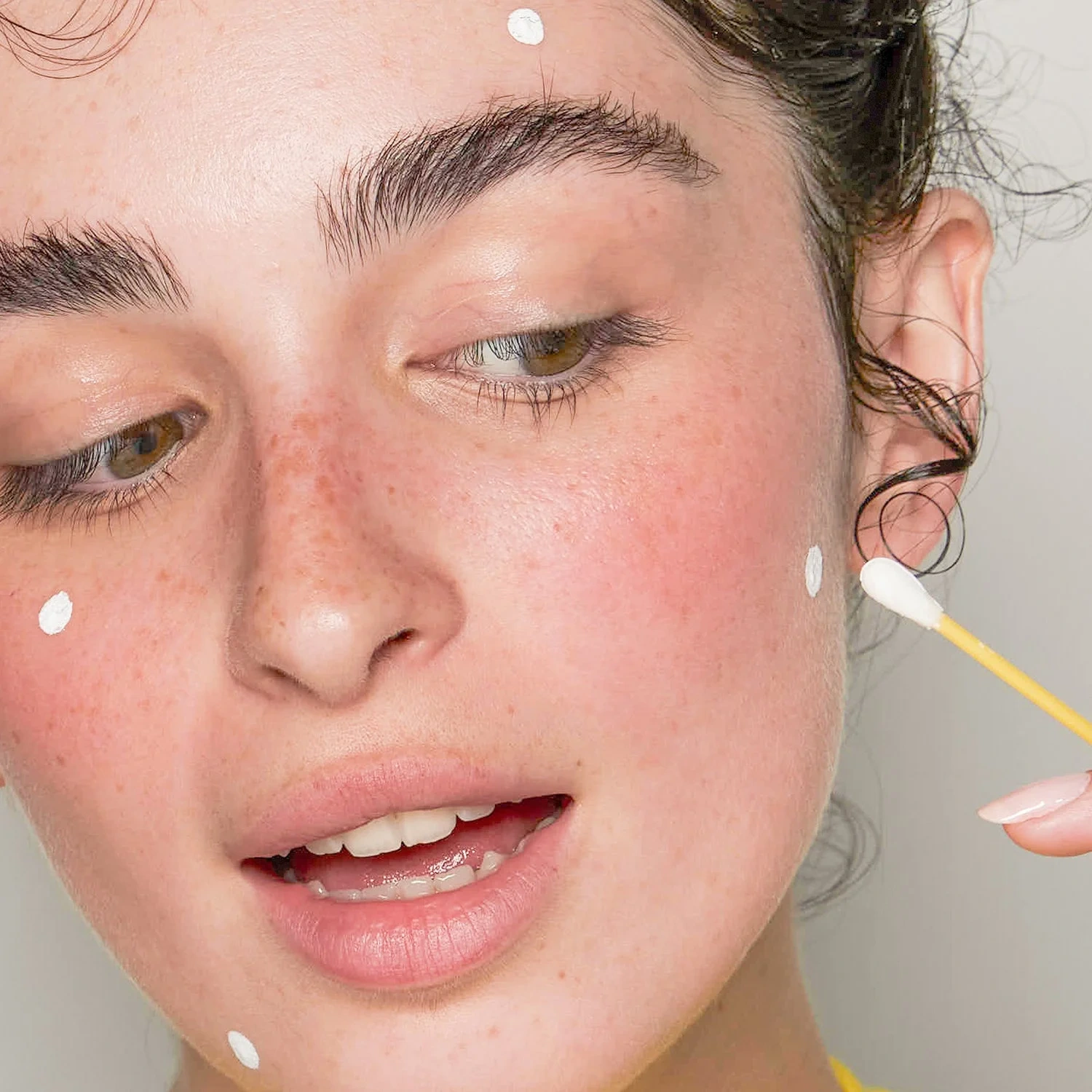Niche Beauty Lab Acnemy