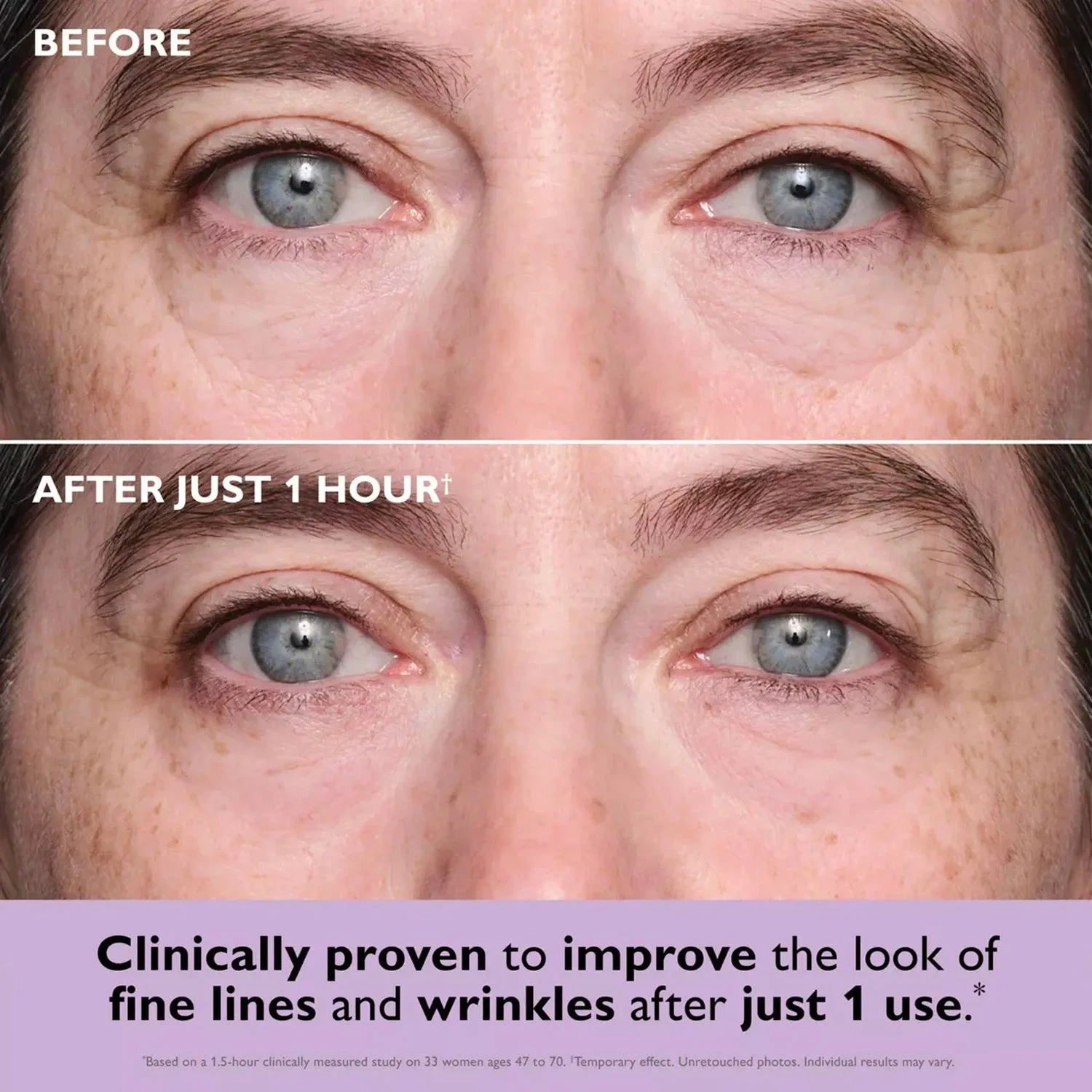 Peter Thomas Roth Instant FIRMx® Collagen Infusion Tightening Eye Patches