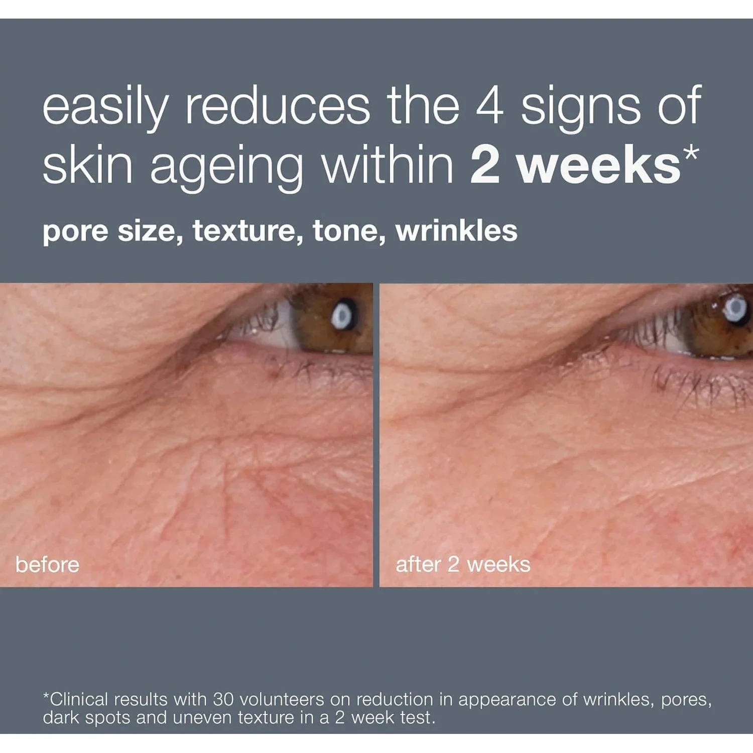 Dermalogica Dynamic Skin Retinol Serum
