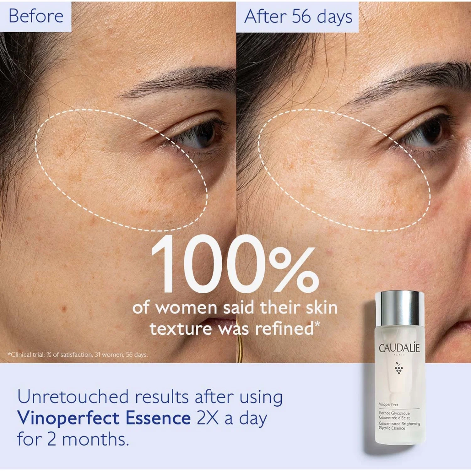 Caudalíe Vinoperfect Concentrated Glycolic Essence 100 ml
