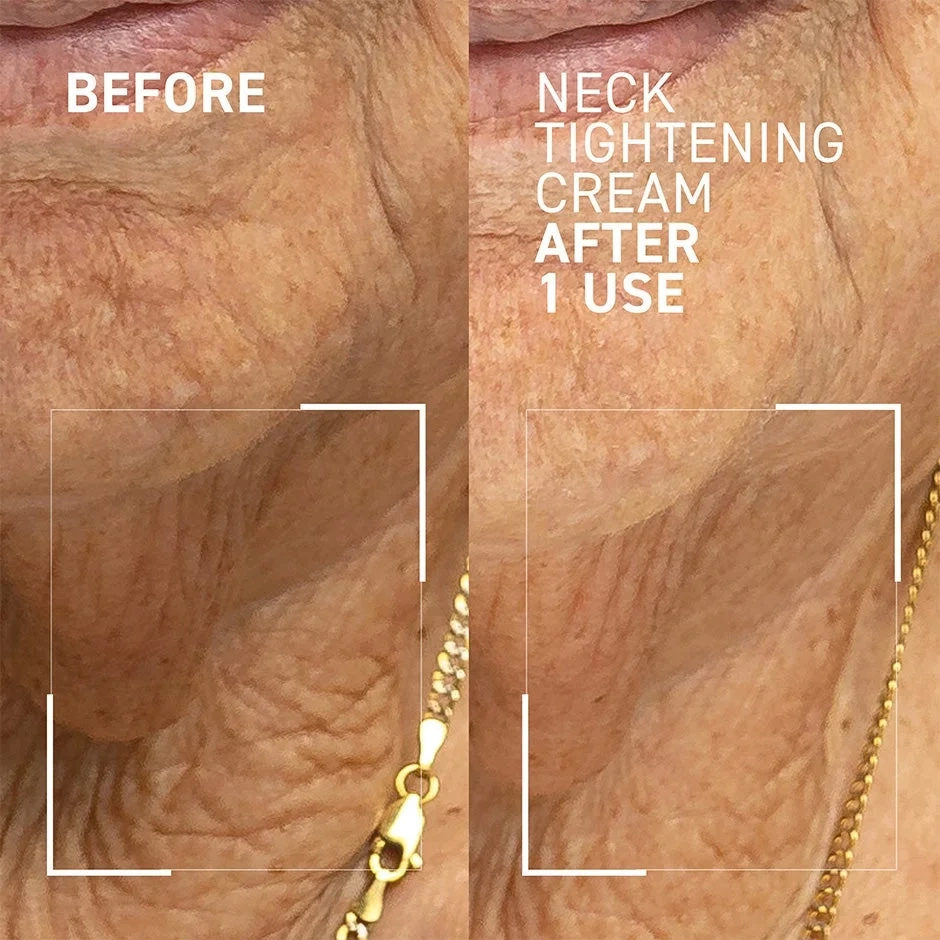 Dr Brandt Neck Tightening Cream