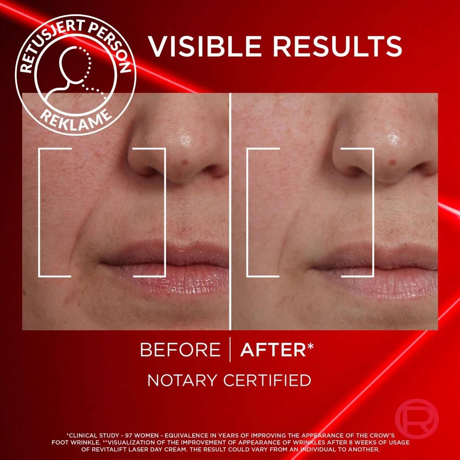 L'Oréal Paris Revitalift Laser Day Cream 50 ml