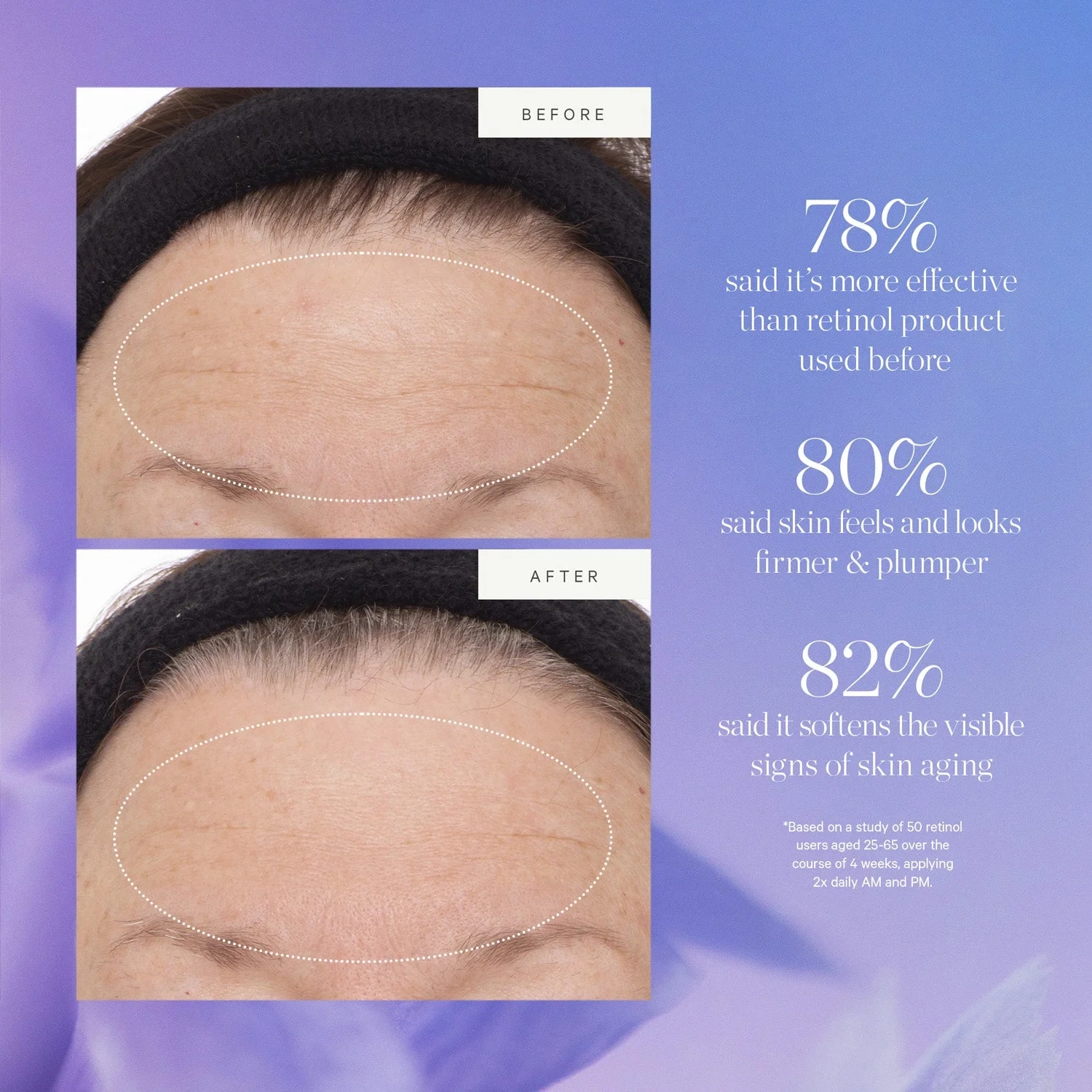 KORA Organics Plant Stem Cell Retinol Alternative Serum