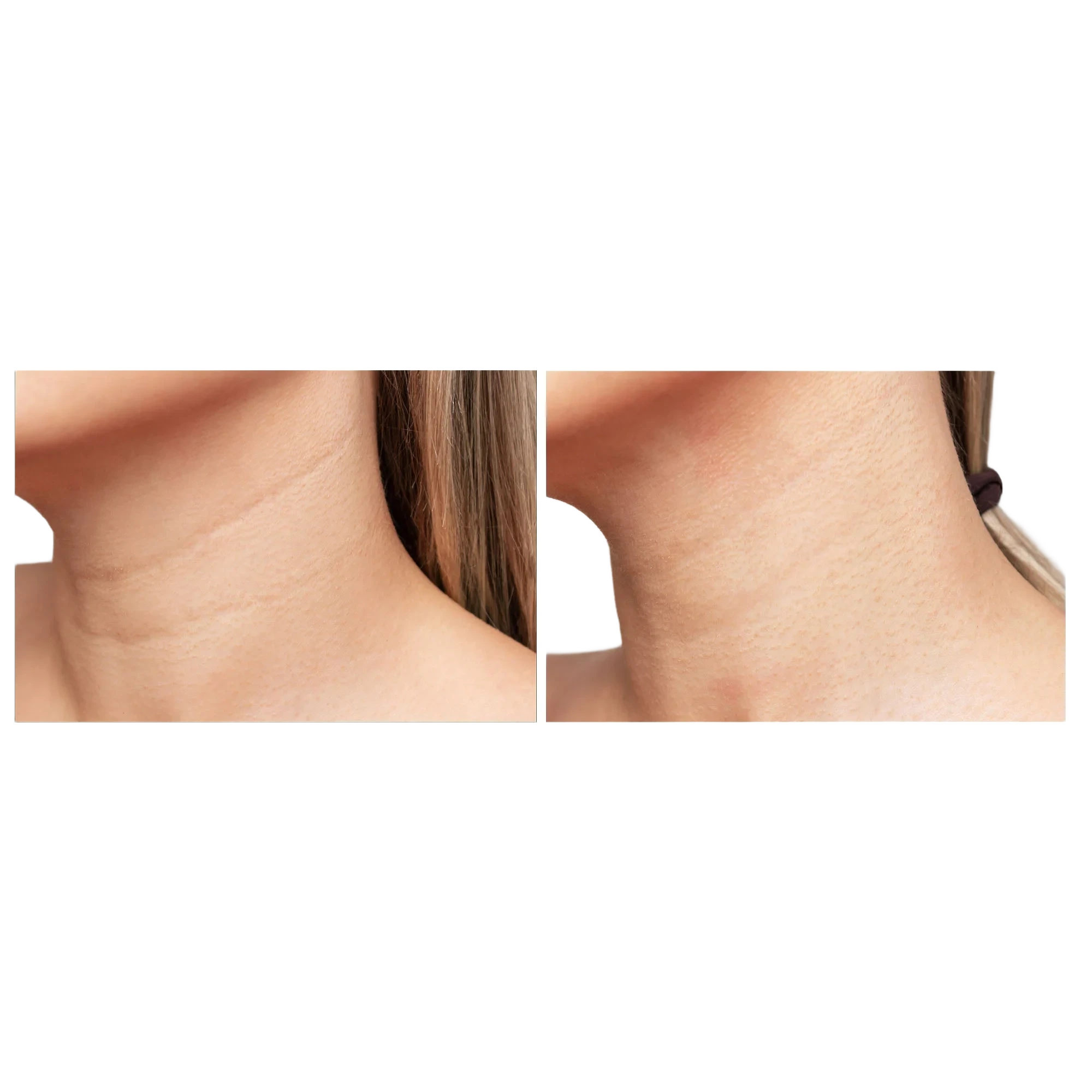 FAQ Swiss FAQ™ 211 LED Neck & Décolleté Mask
