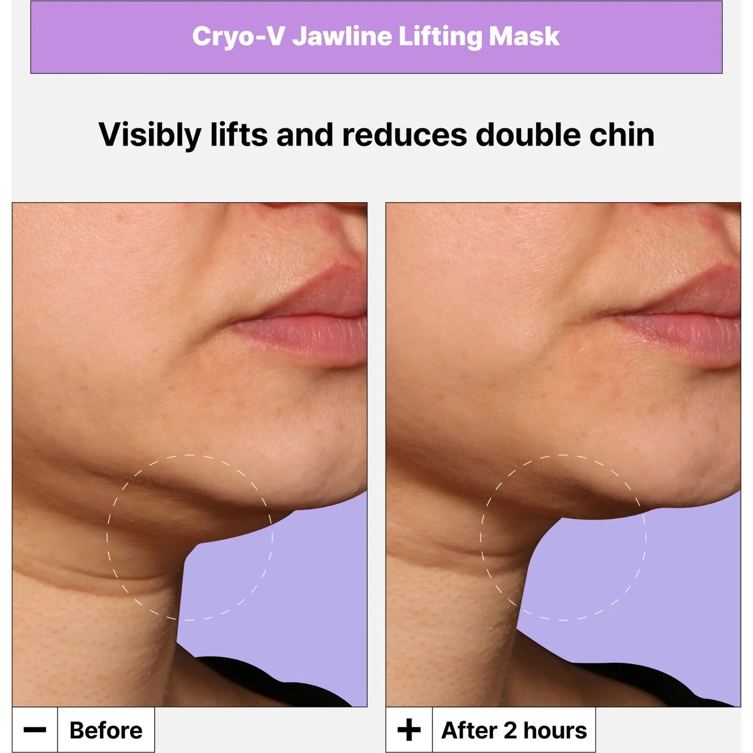 Dr.Jart+ Cryo V-Sculpt Jawline Lifting Mask