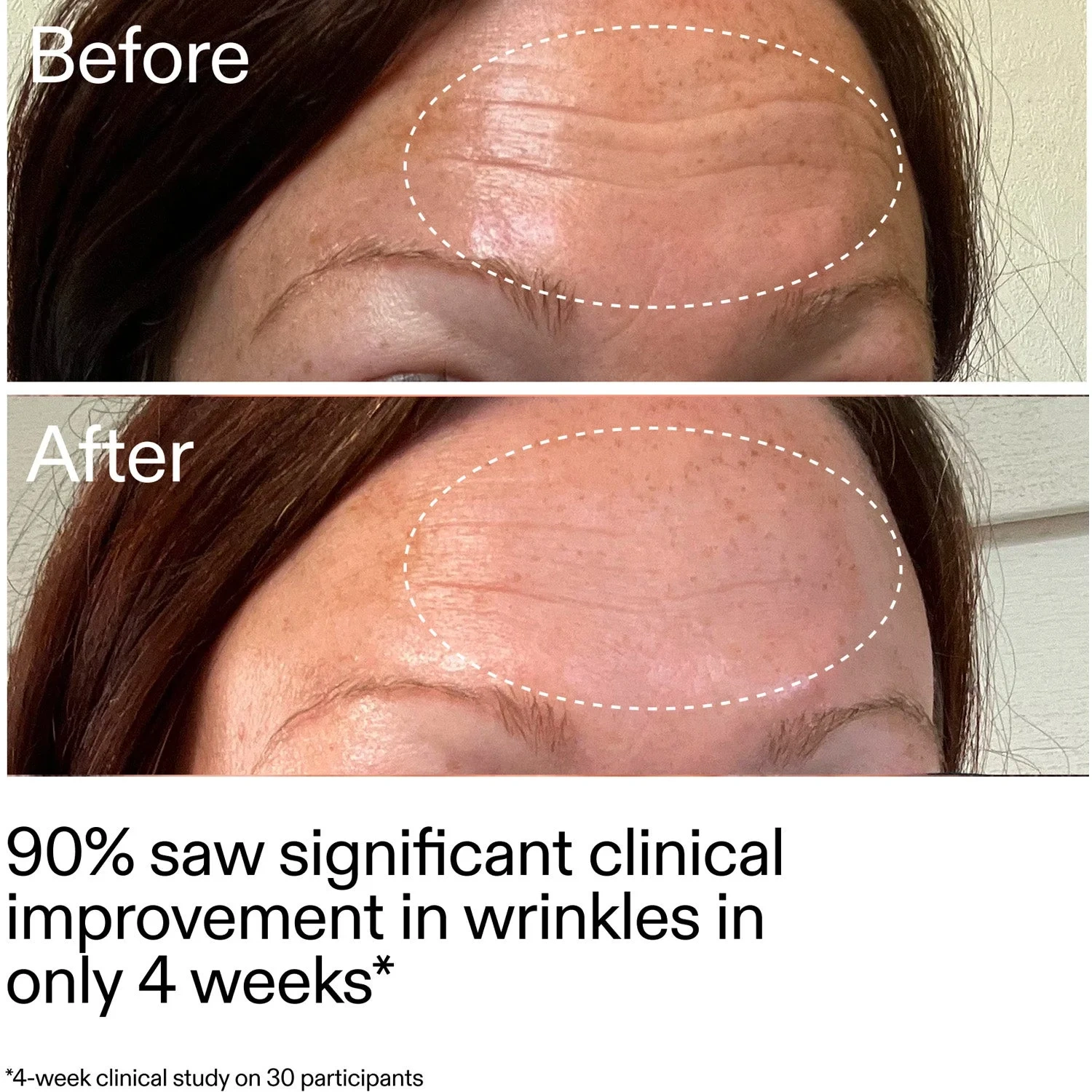 The INKEY List Starter Retinol Serum