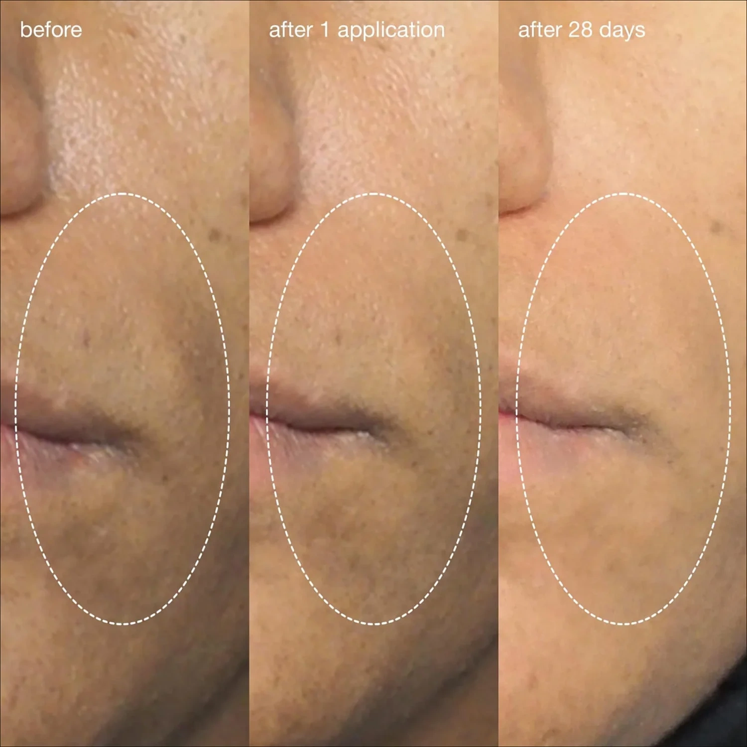 Dermalogica Daily Liquid Peelfoliant