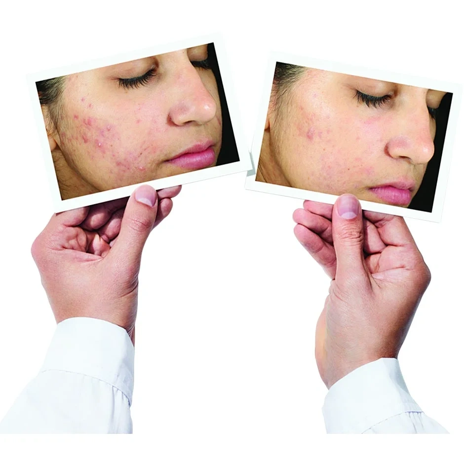 Murad Invisiscar Resurfacing Treatment 30 ml