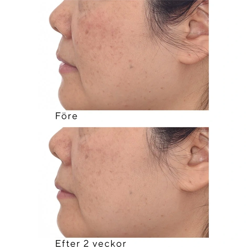 Murad Correct & Protect Serum