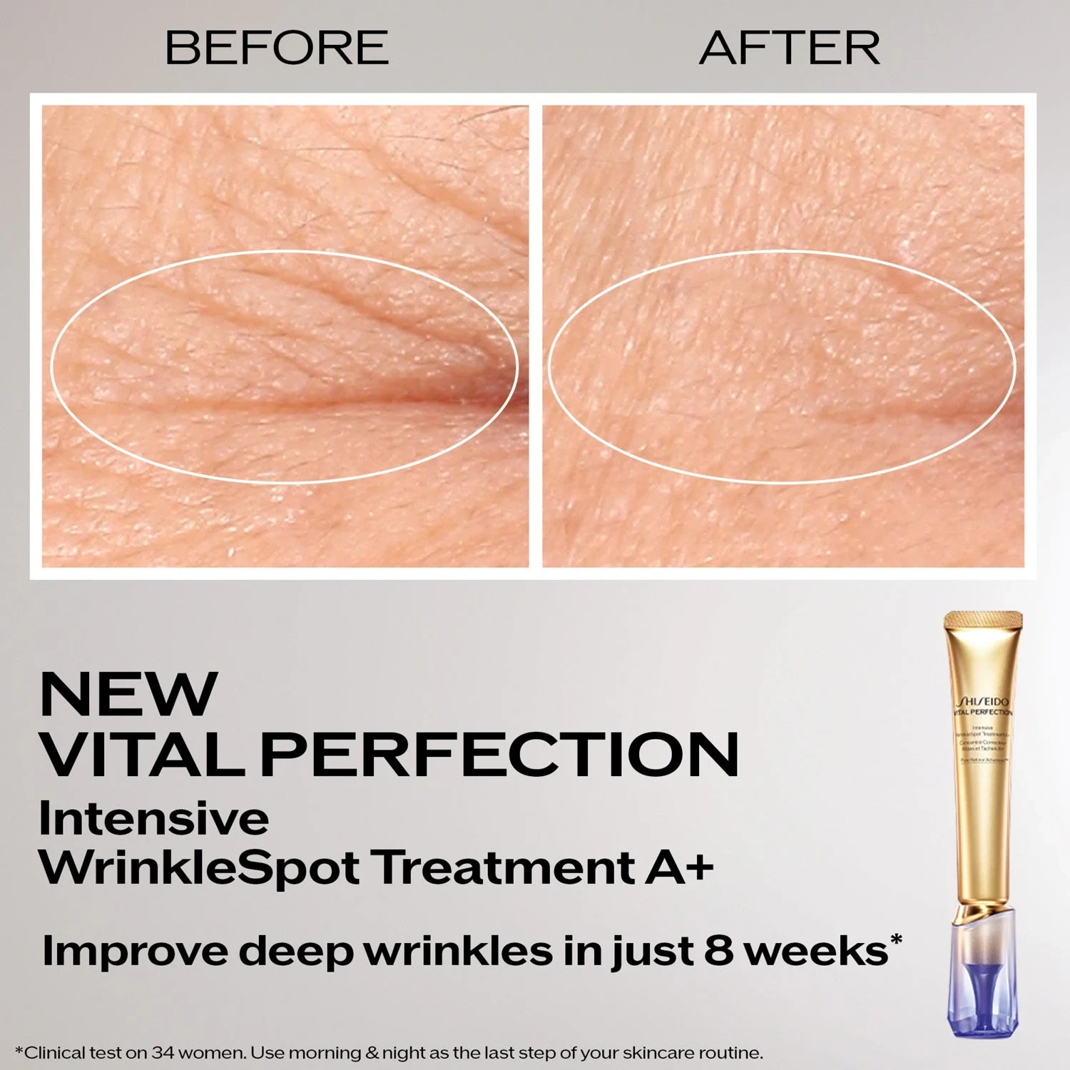 Shiseido Vital Perfection Intensive Wrinklespot Treatment A+