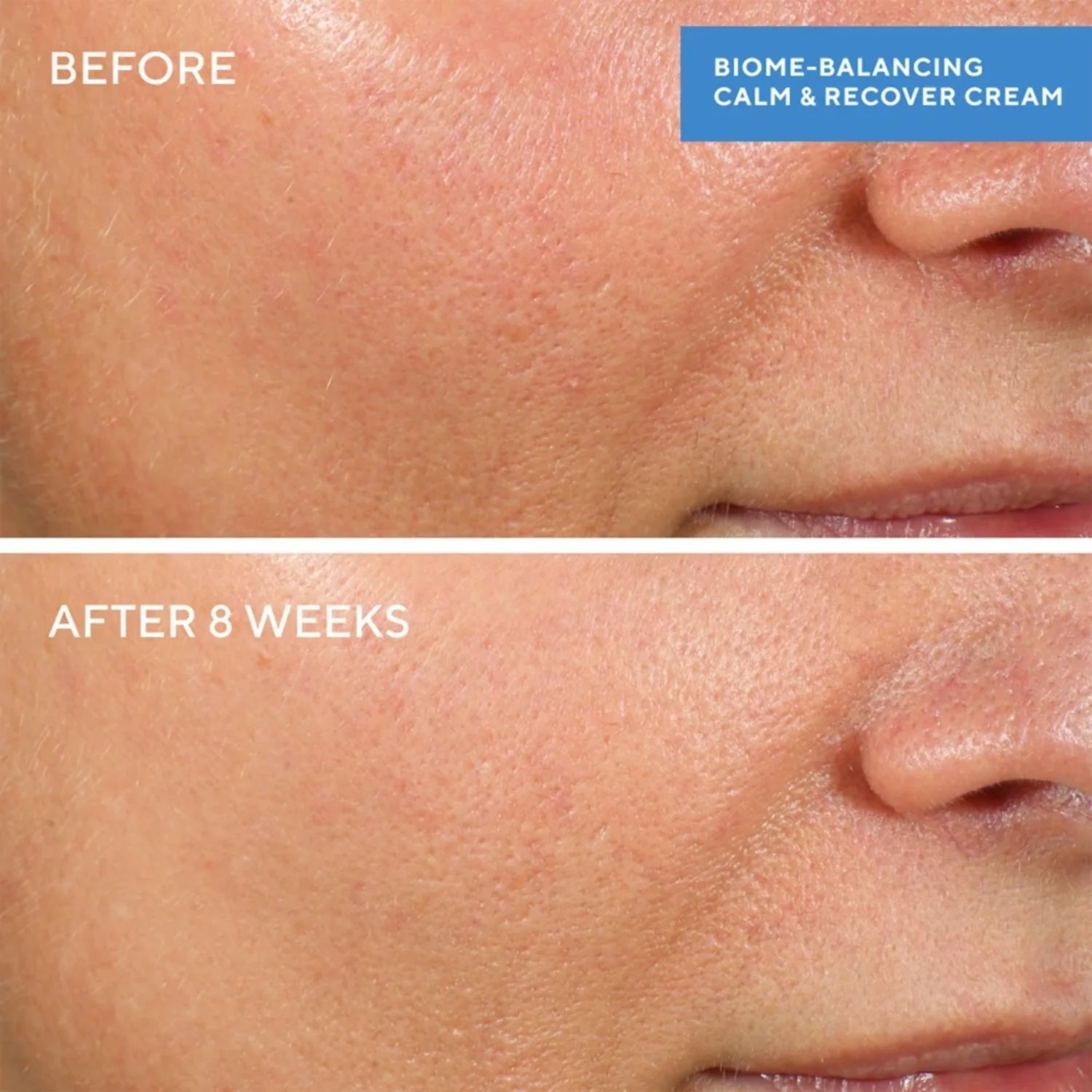 Murad Biome-Balancing Calm + Recover Cream