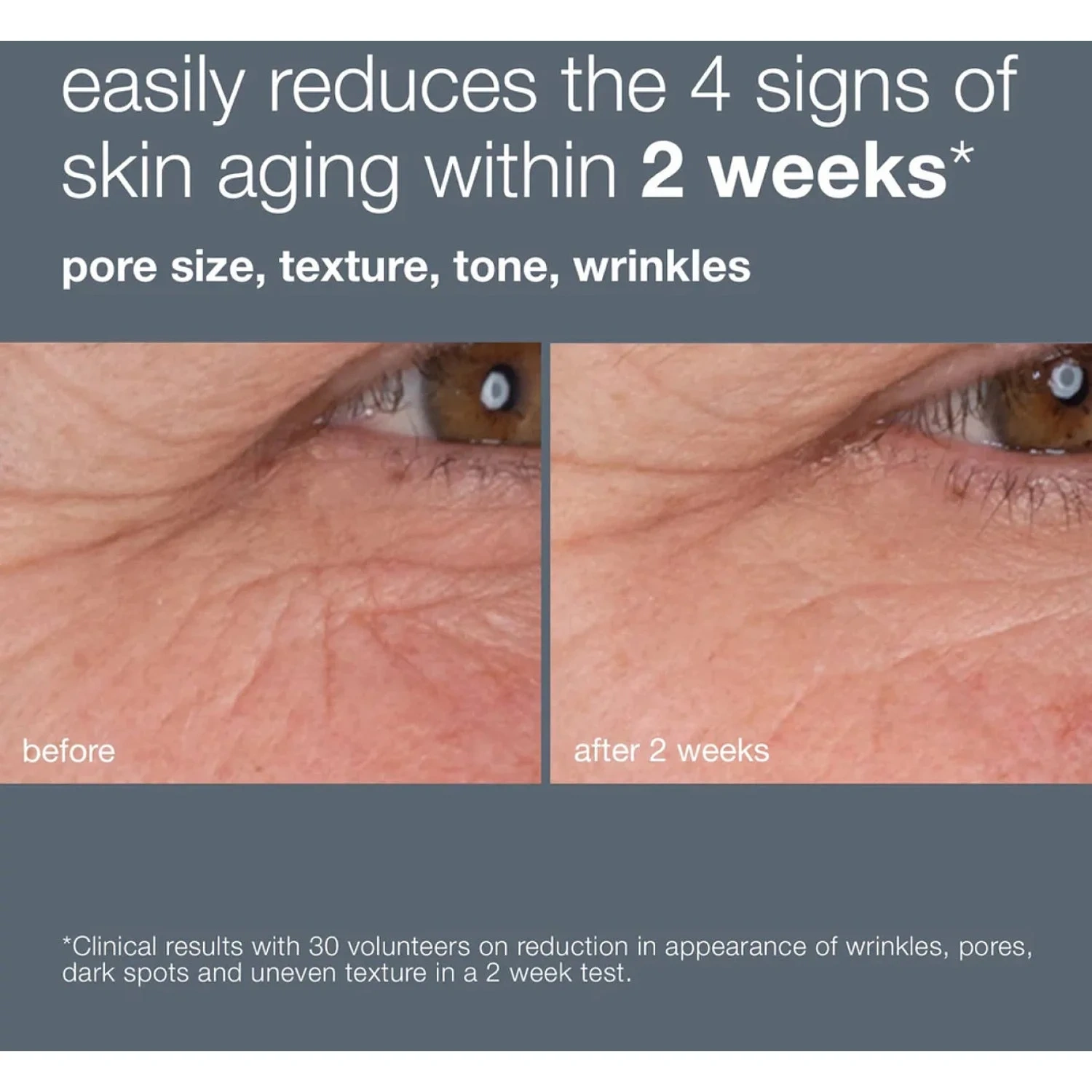 Dermalogica Dynamic Skin Retinol Serum