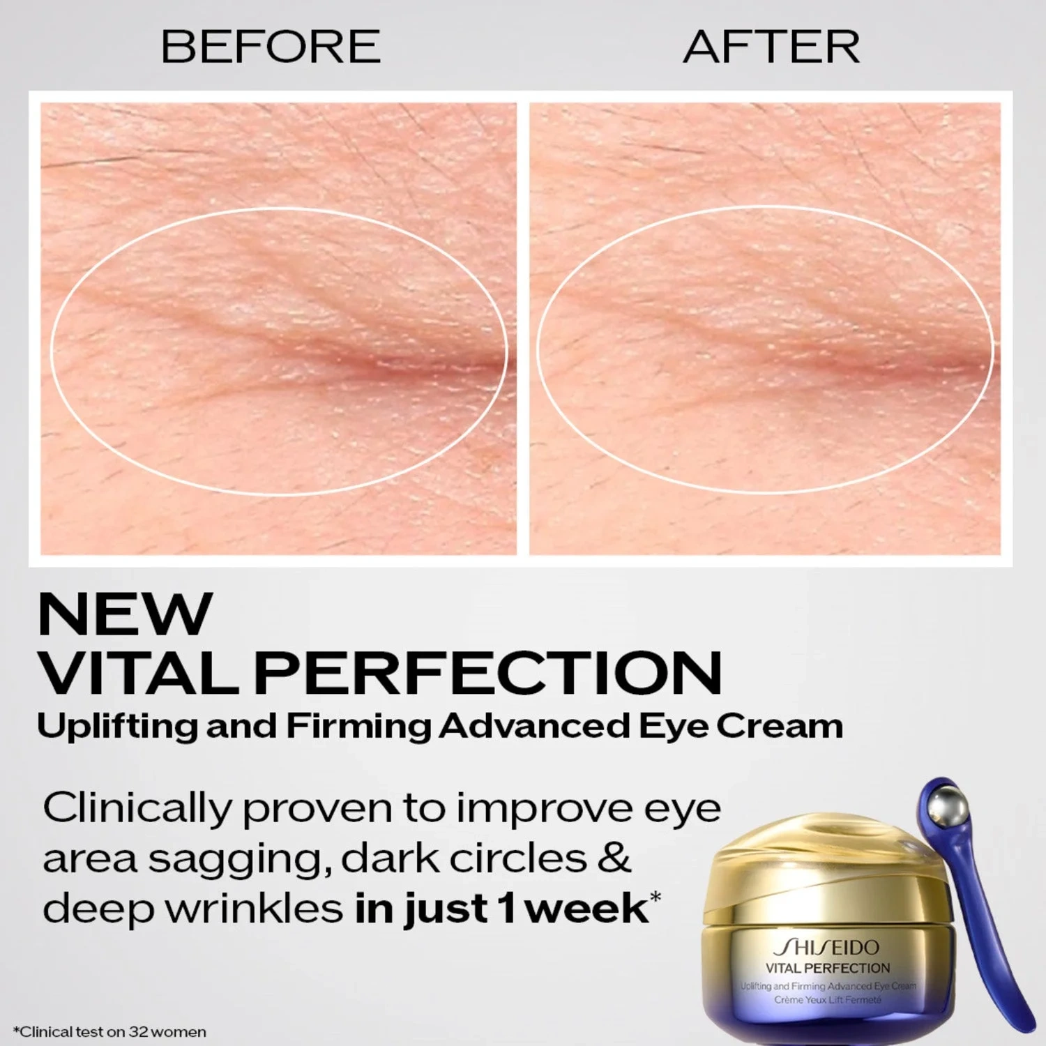 Shiseido Vital Perfection Uplifting & Firming Advanced Eye Cream